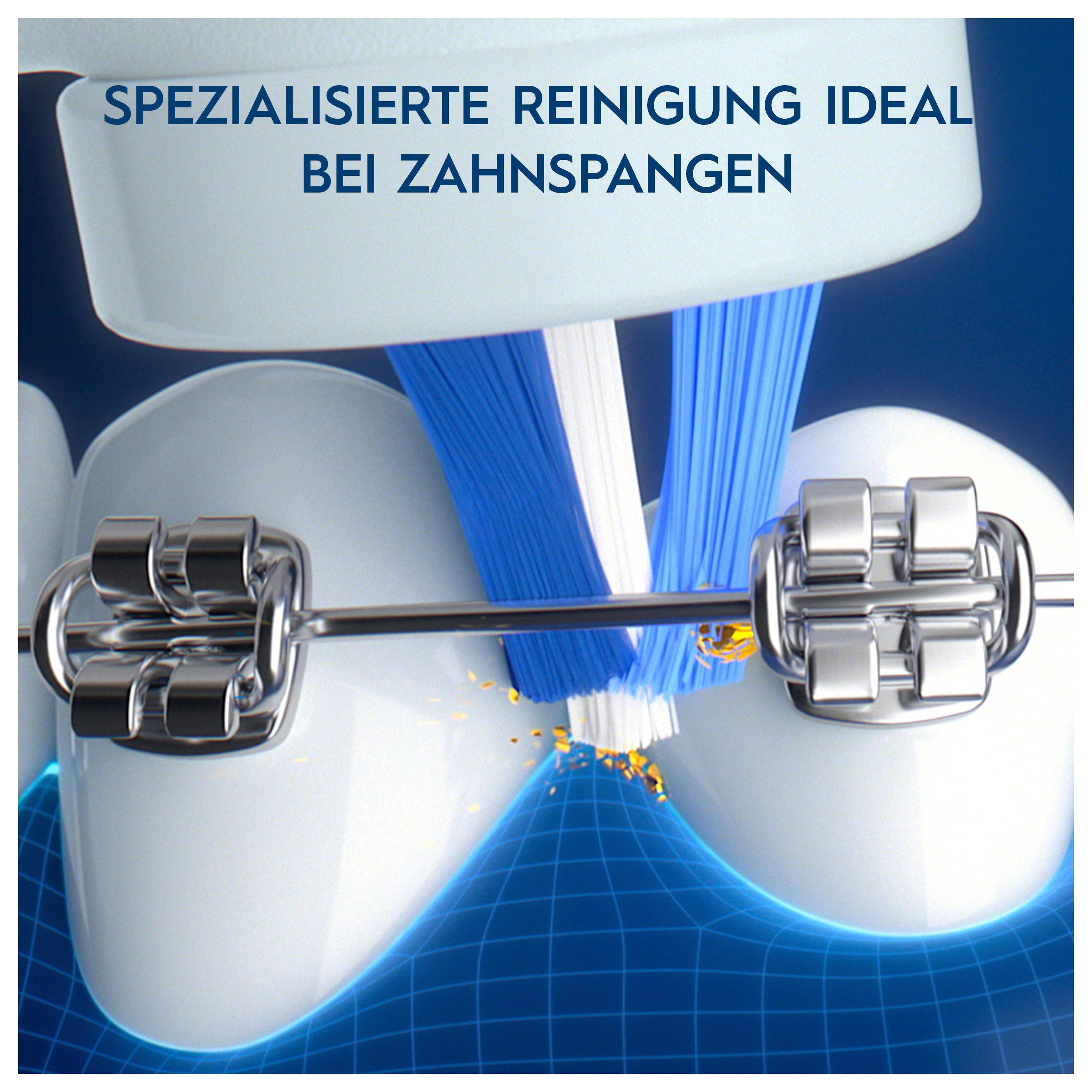 Zähne mit Zahnspange werden von einer Zahnbürste mit blauen und weißen Borsten gereinigt.