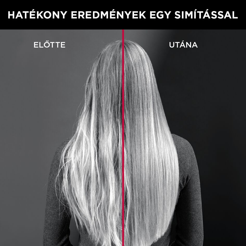 Haj összehasonlítás kezelés előtt és után. Szürke haj mindkét oldalon. Magyar szöveg.