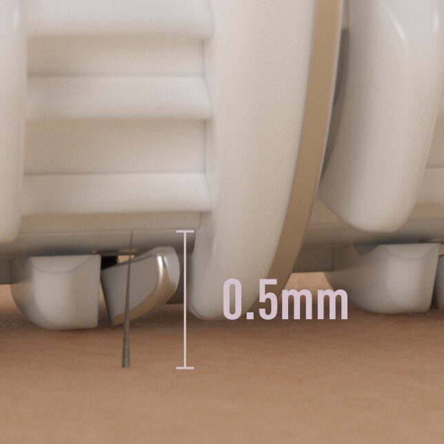 Zbliżenie zębów z aparatem ortodontycznym. Pokazano pomiar odległości 0,5 mm.