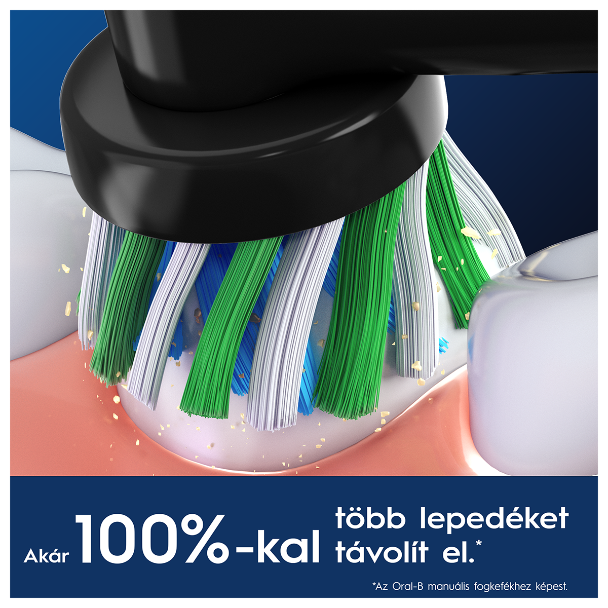 Közelkép egy fogkeféről, amely tisztítja a fogakat, eltávolítva a törmeléket és a lepedéket.