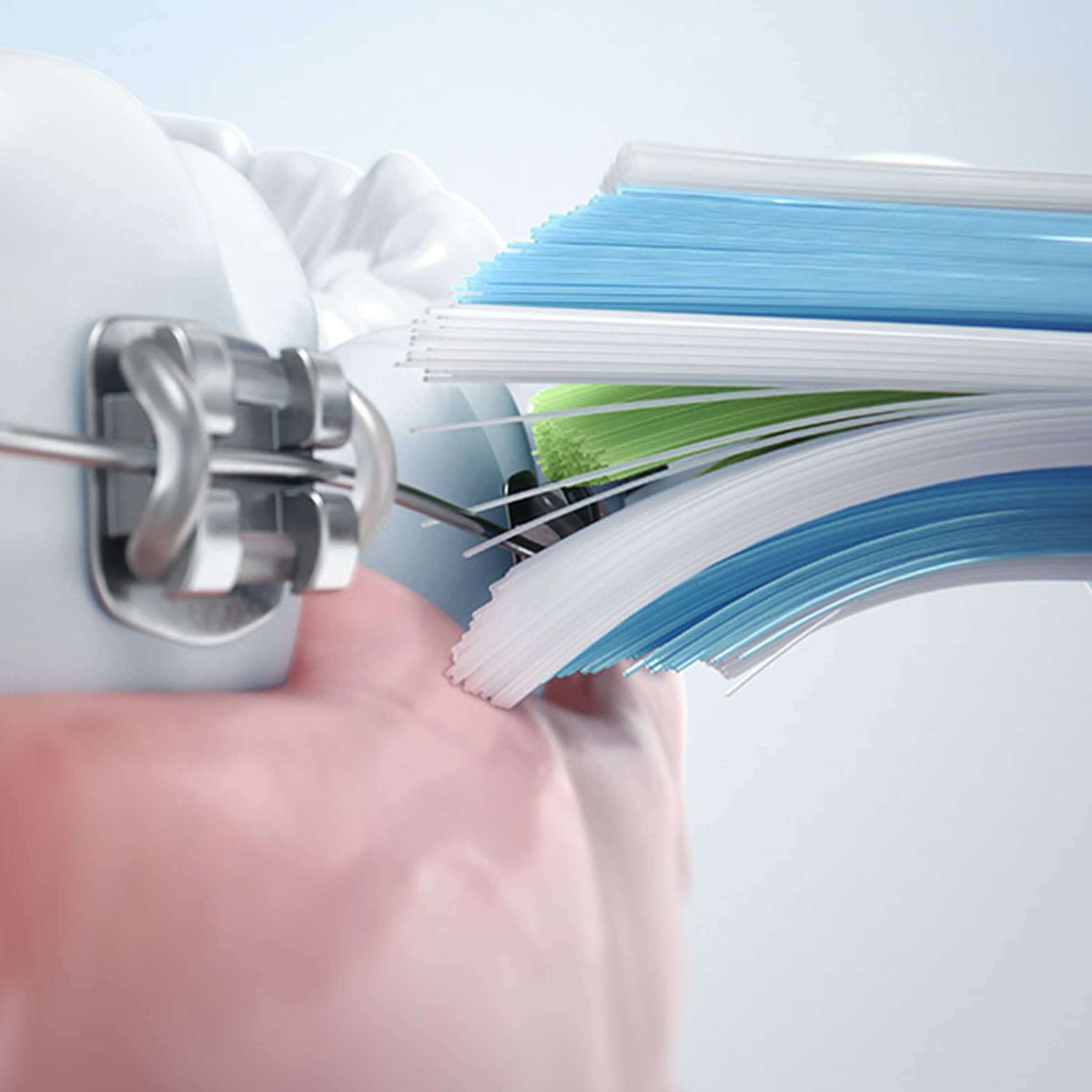 Zbliżenie włosia szczoteczki do zębów czyszczącego zęby z widocznym aparatem.