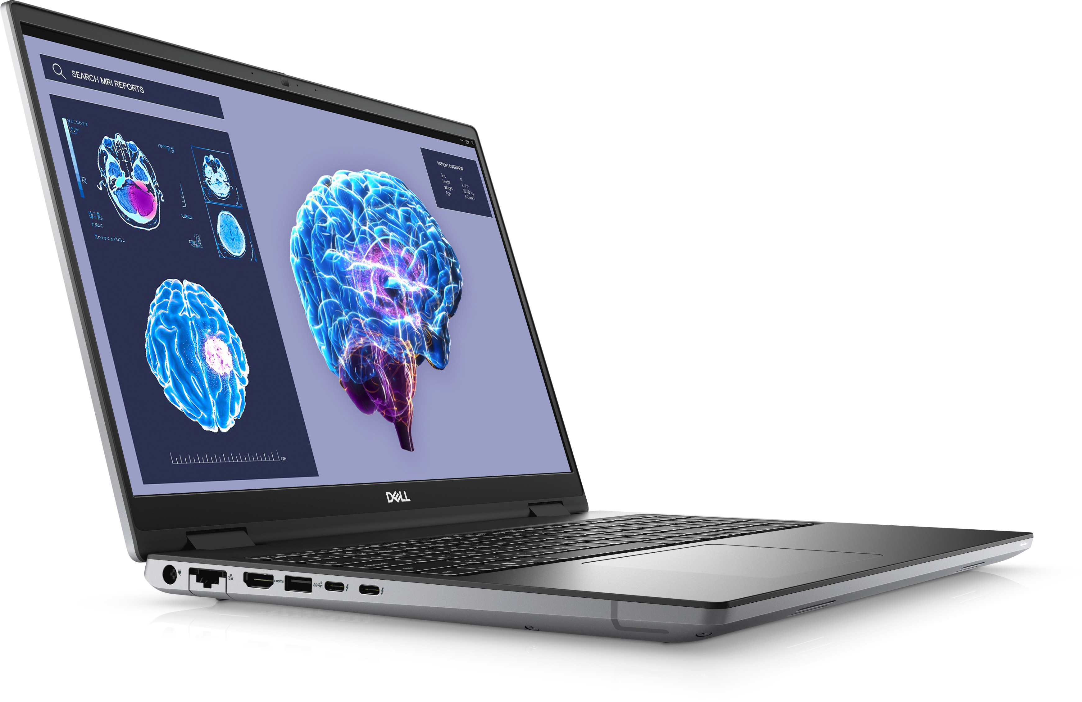 Ein Dell-Laptop ist geöffnet und zeigt einen medizinischen Gehirnscan auf dem Bildschirm.
