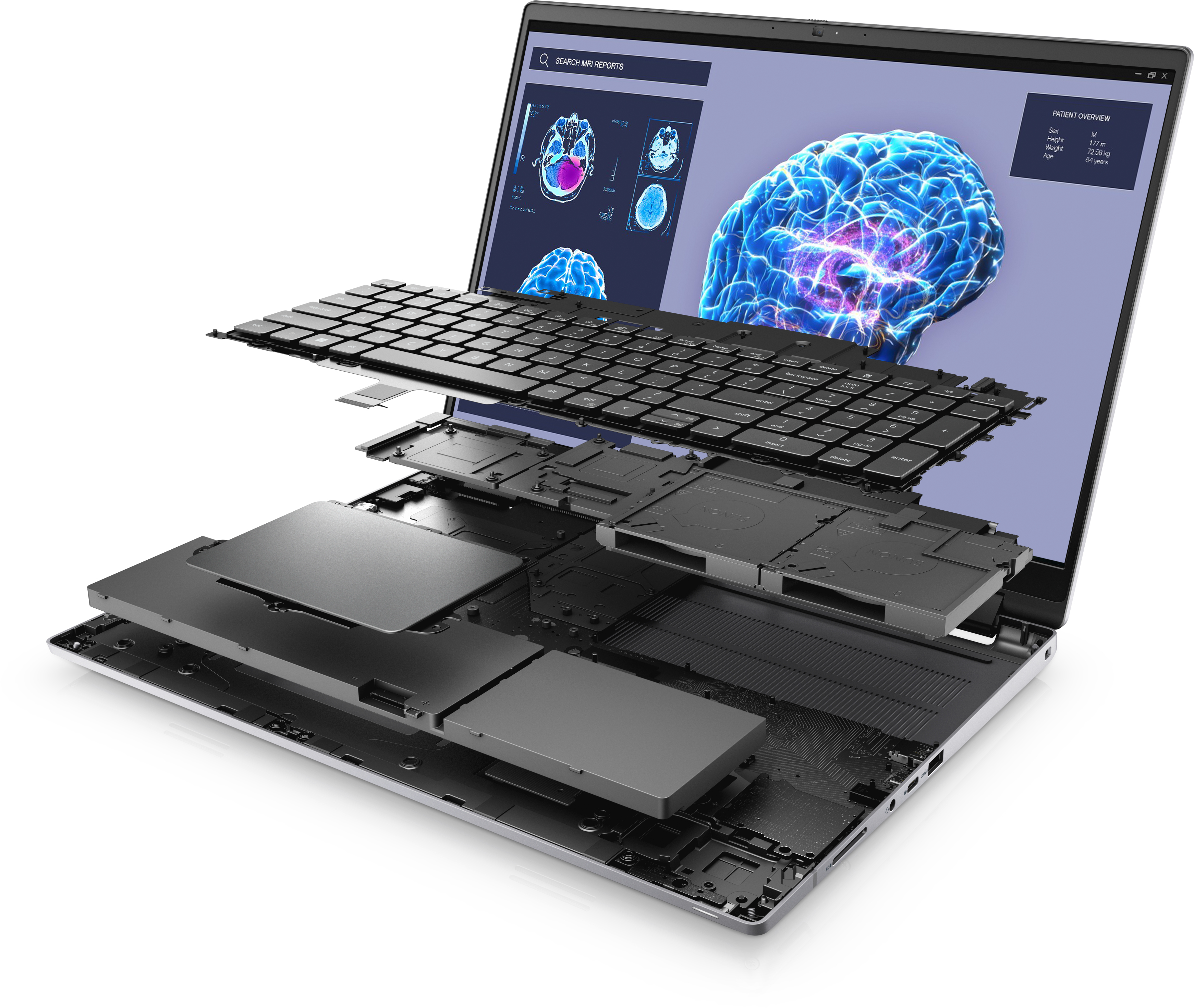 Explosionsansicht eines Laptops mit internen Komponenten, Hirnscan auf dem Bildschirm.