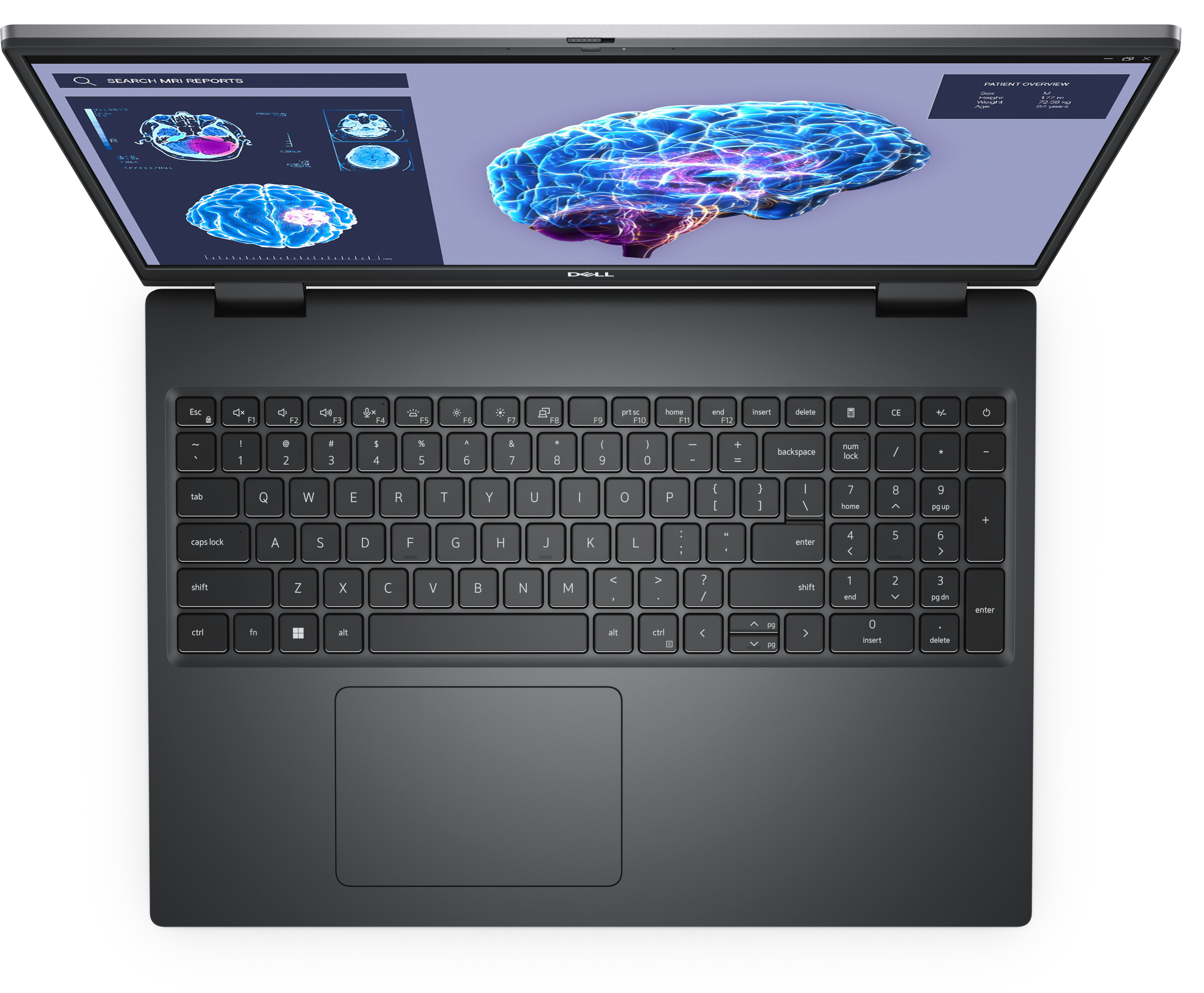 Ein Laptop, der Gehirnscan-Bilder auf dem Bildschirm anzeigt.