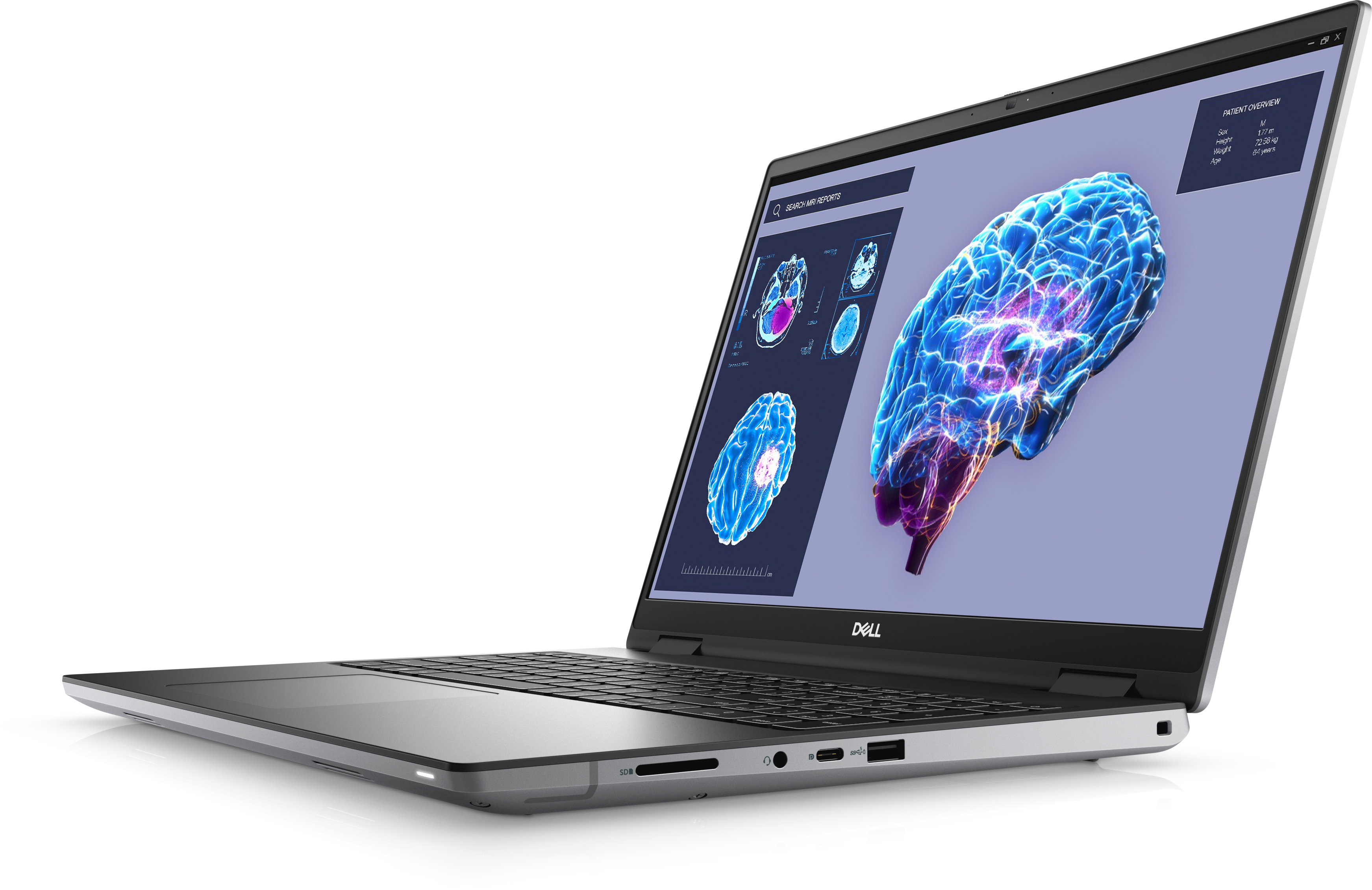 Ein Dell-Laptop ist geöffnet und zeigt einen Gehirnscan mit medizinischen Details.