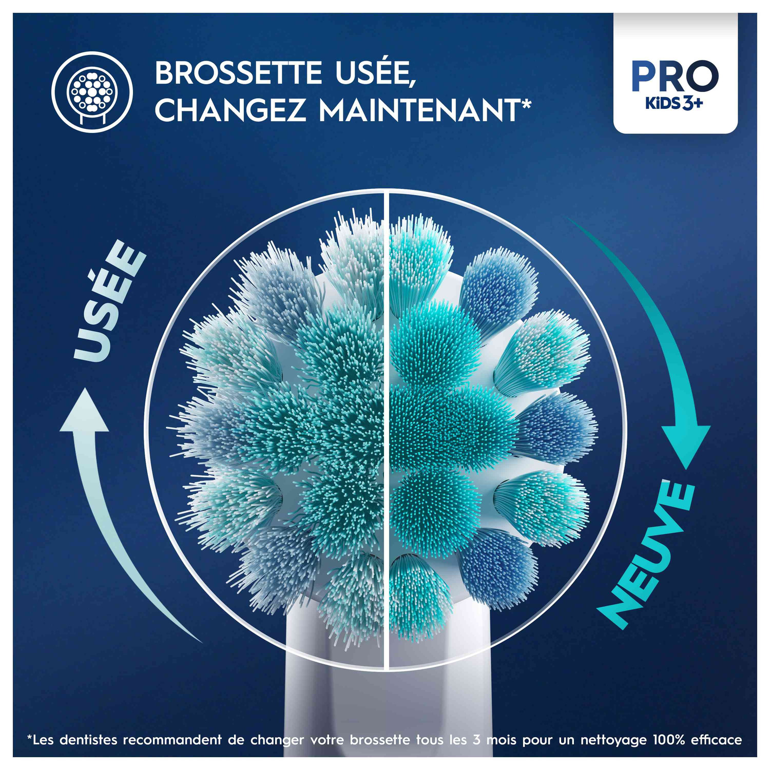 Une tête de brosse à dents montrant des poils usés d'un côté par rapport à des poils neufs de l'autre.