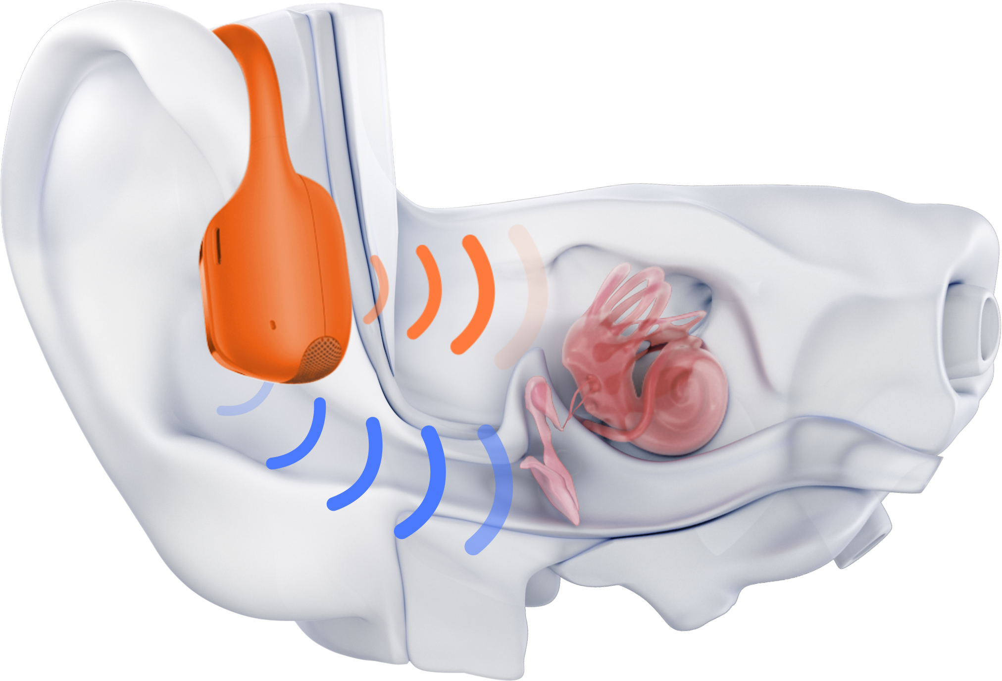 Anatomische Darstellung eines Ohrs mit einem Hörgerät.