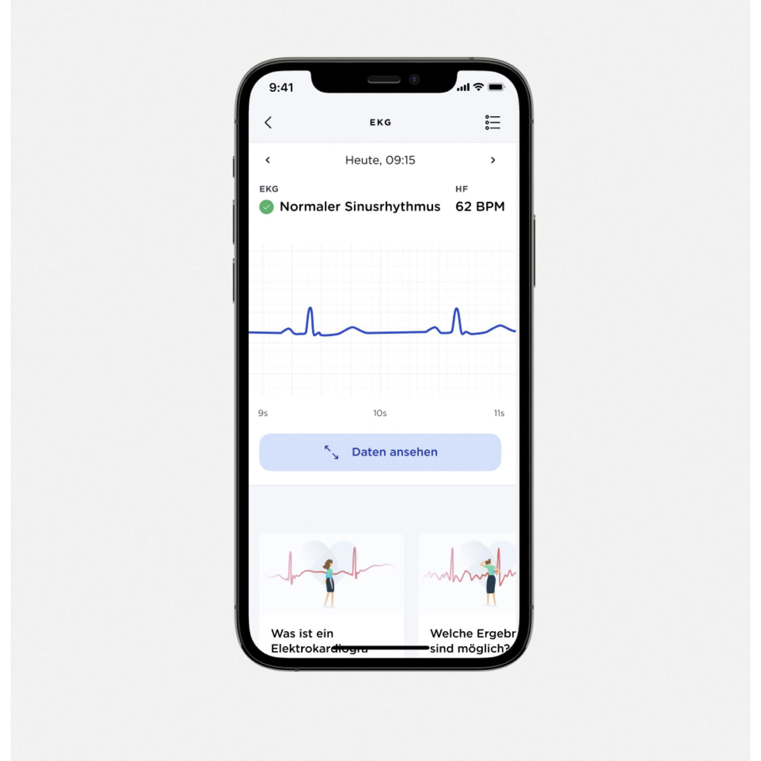Ein iPhone zeigt ein EKG mit normalem Sinusrhythmus und Herzfrequenz.