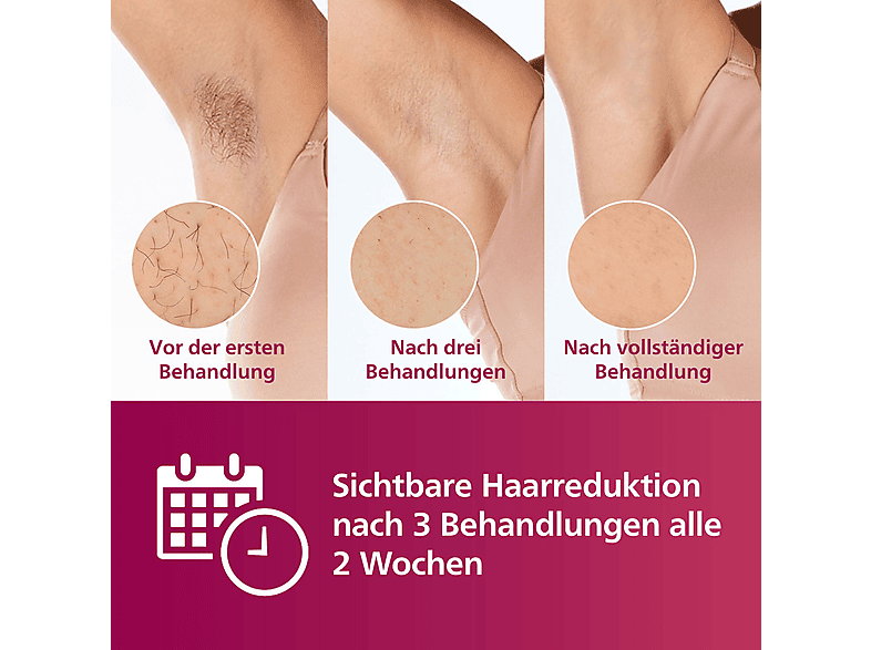 Thumbnail - PHILIPS Lumea IPL Advanced BRI923/00 7000 Series langanhaltend seidig glatte Haut Haarentfernung Weiß