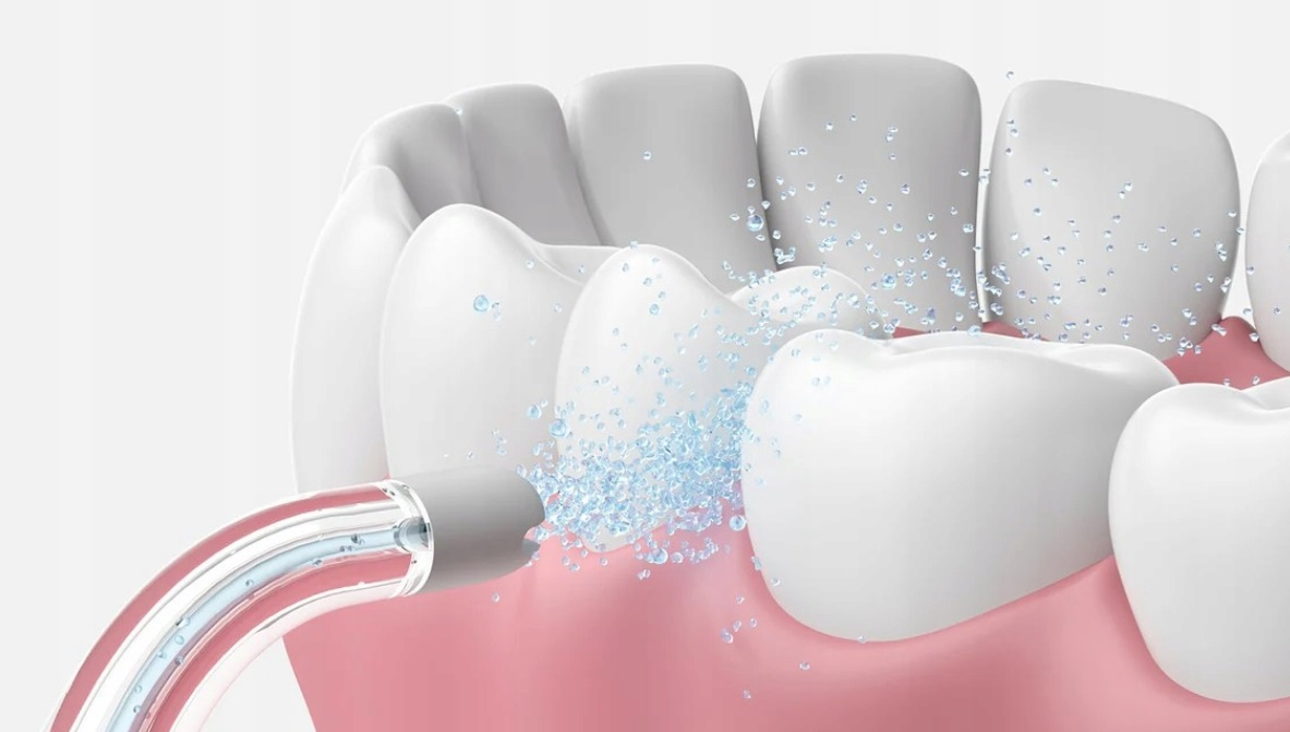 Czyszczenie zębów irygatorem, zbliżenie, ze spryskiwaniem wodą.