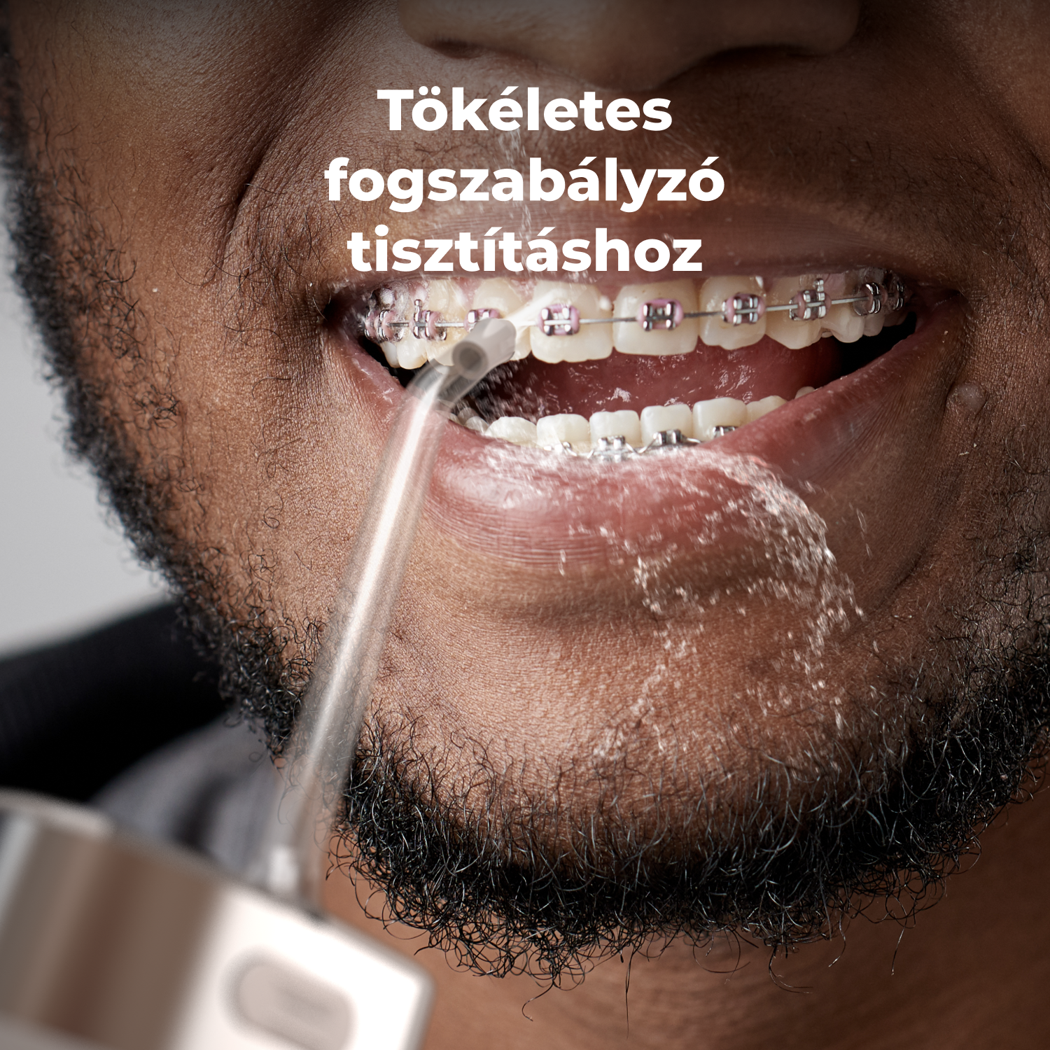 Fogszabályzós száj, fogászati vízsugárral tisztítva.