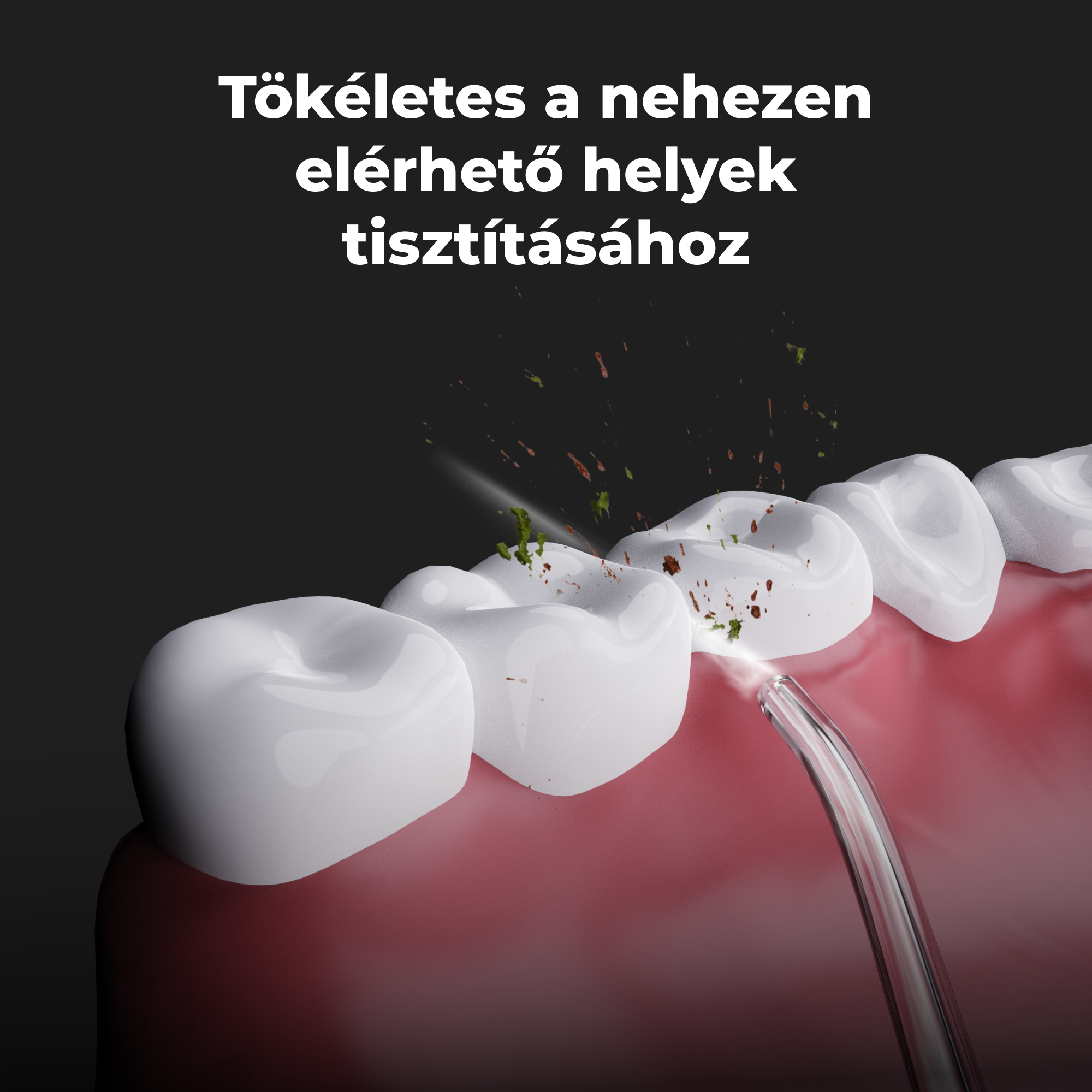 Fogak tisztítása szájzuhannyal. Zöld és barna részecskék láthatók.