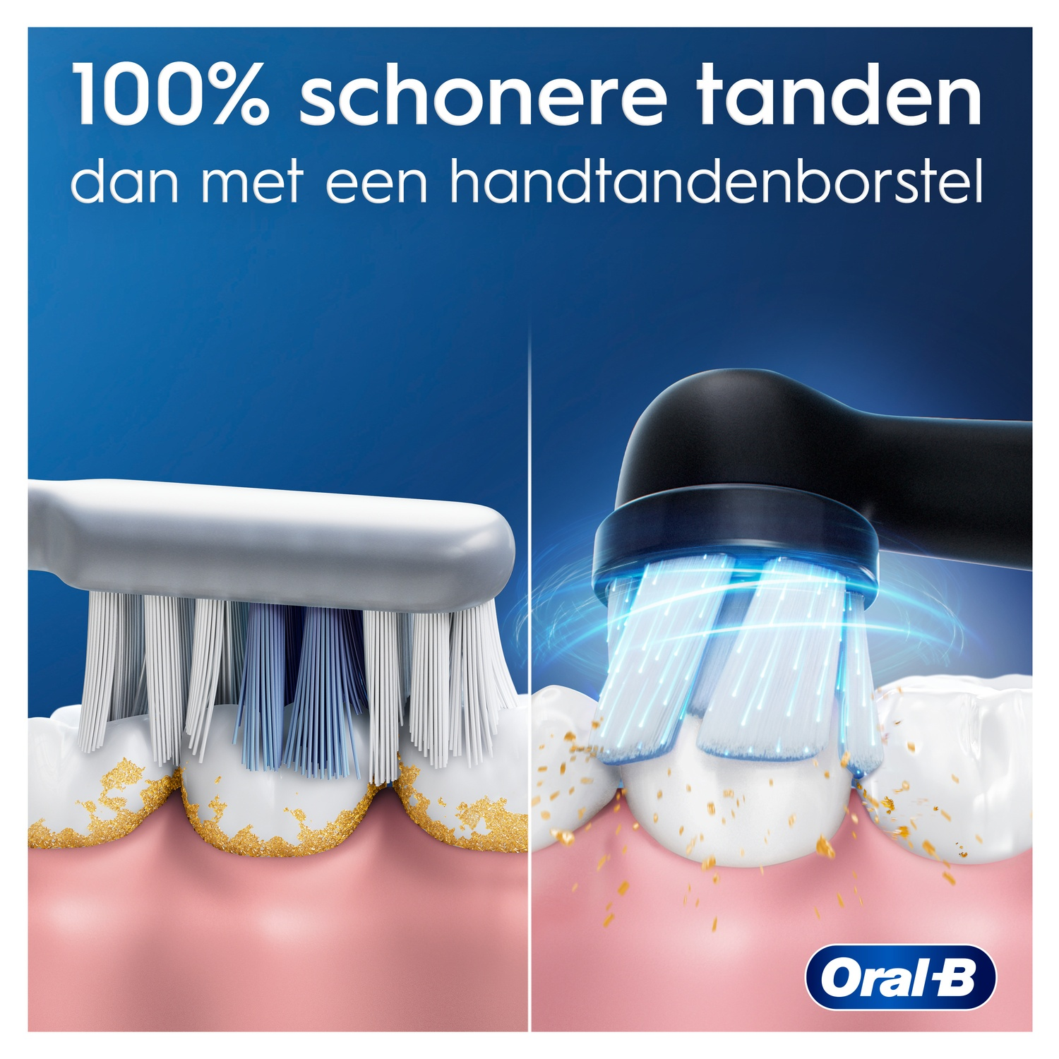Vergelijking van elektrische tandenborstel, met schonere tanden.