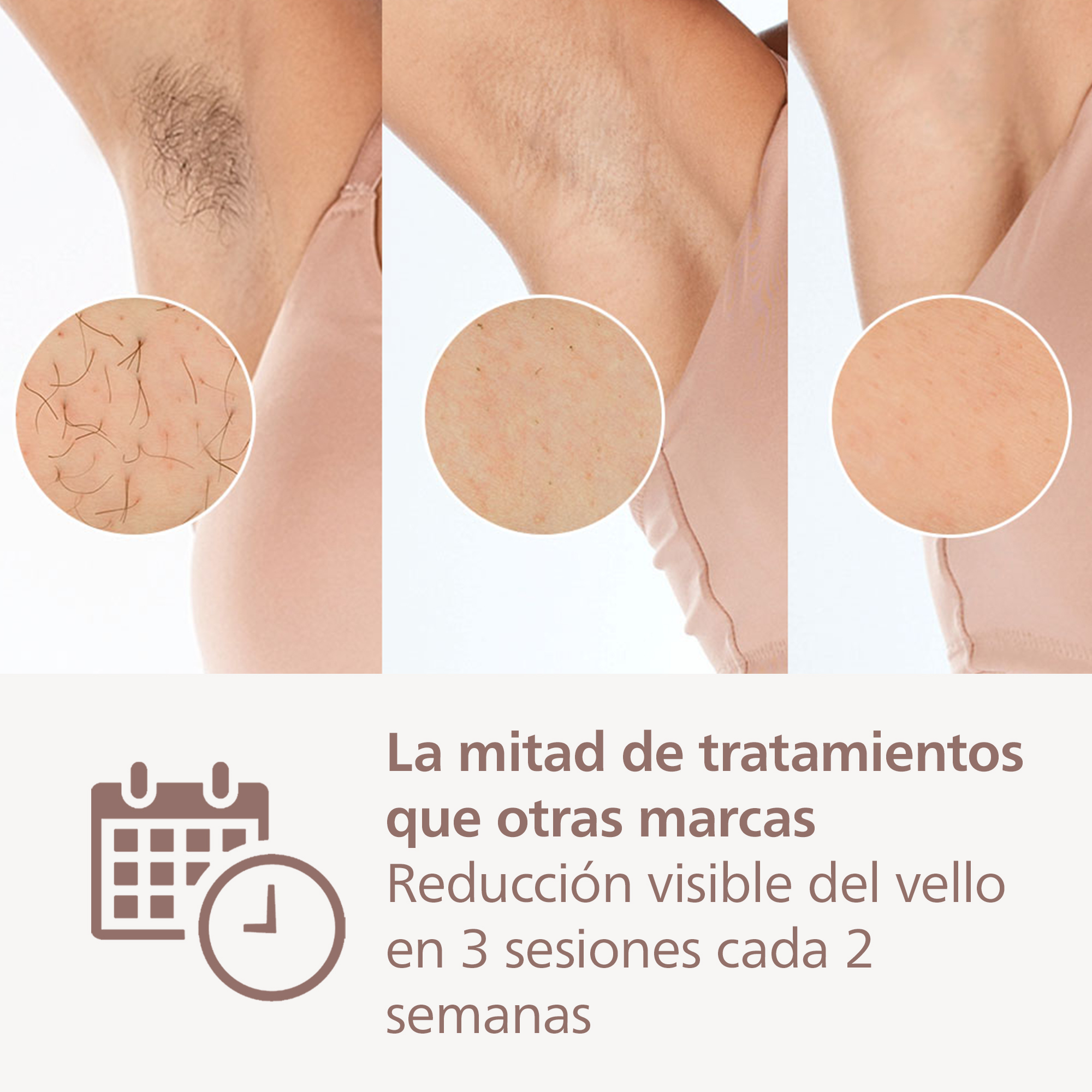 Tres imágenes que muestran el progreso de la depilación. Vello axilar antes y después.