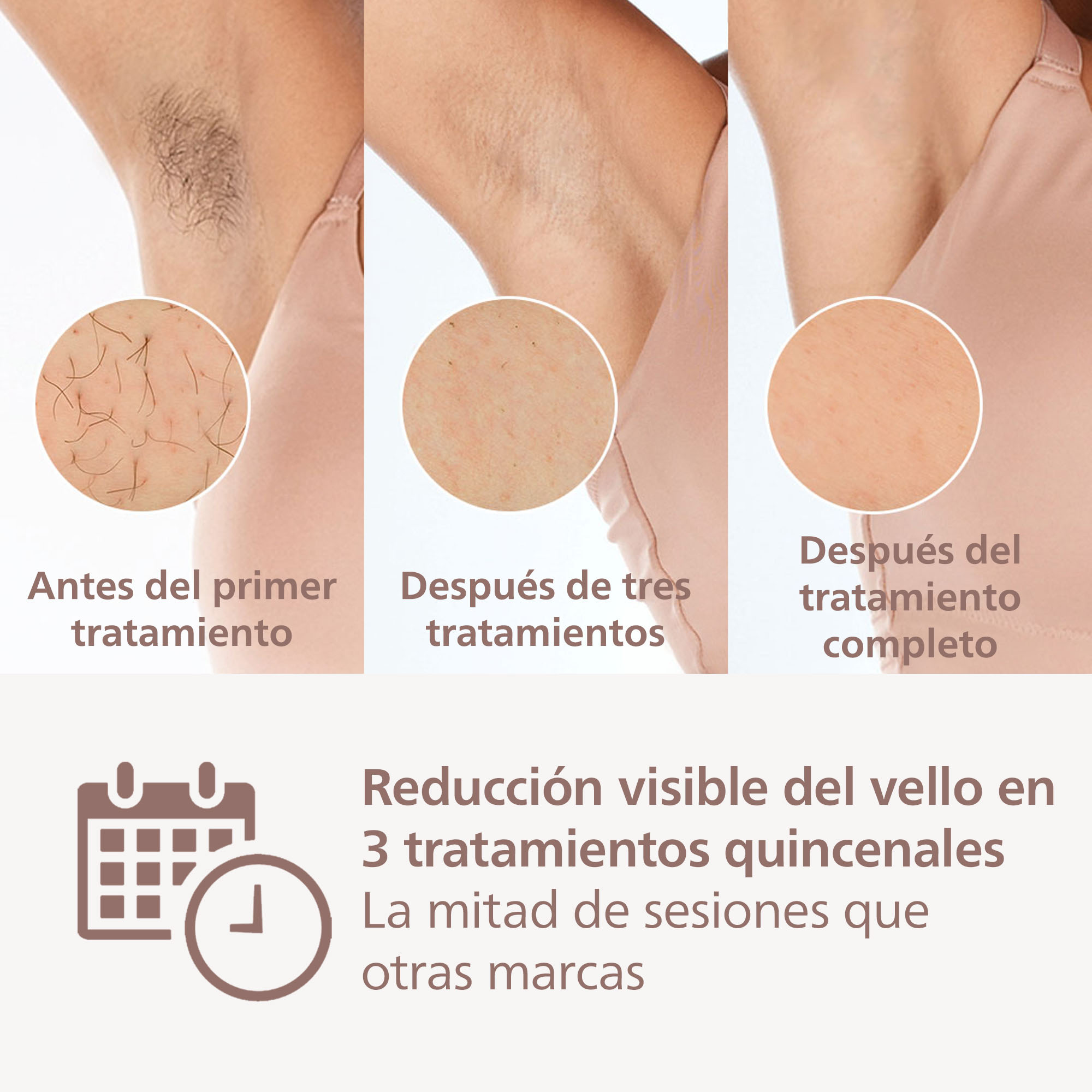 Tres imágenes: axila con vello, después de tres tratamientos, completo.