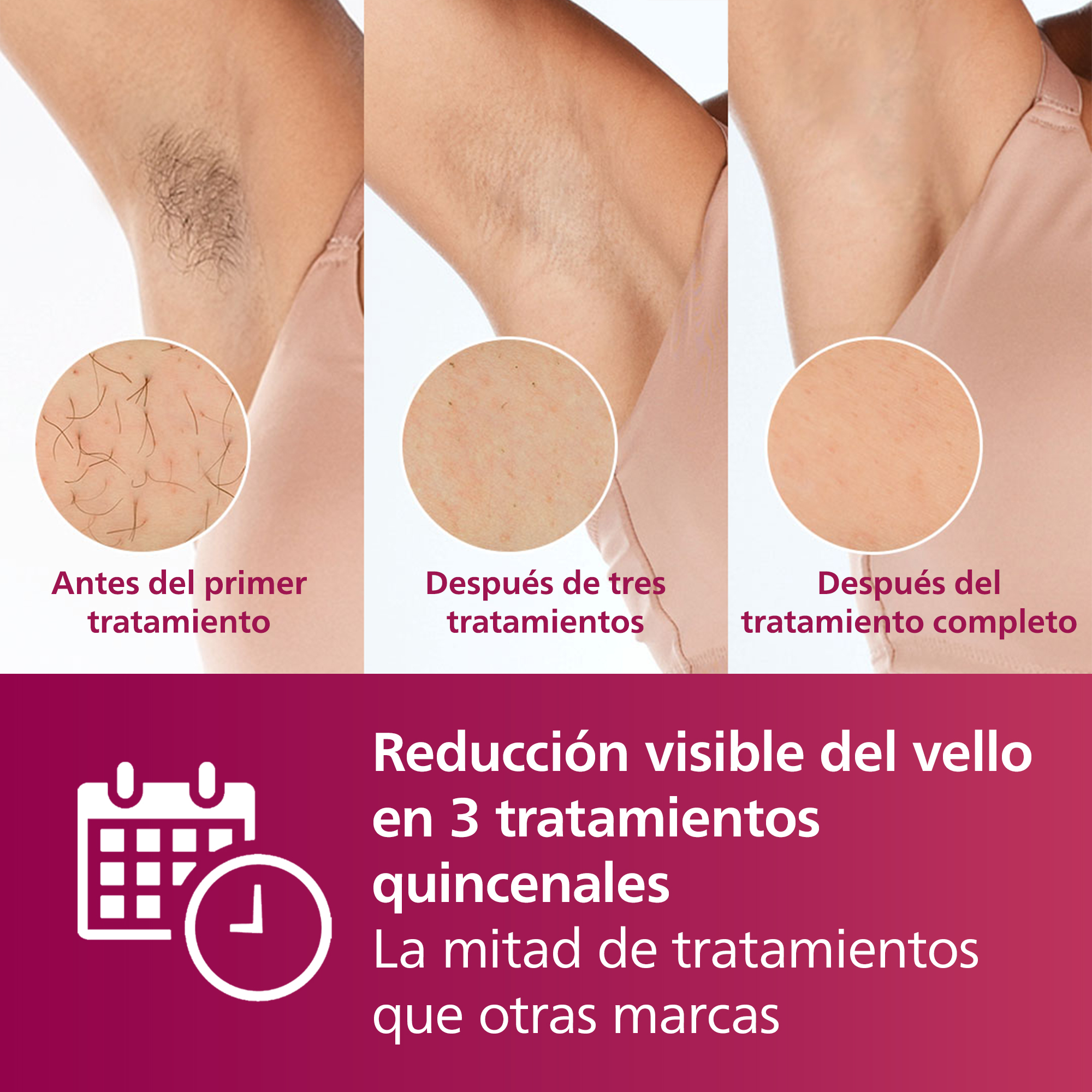 Las imágenes muestran el progreso de la depilación de las axilas. El texto dice 'reducción visible del vello'.