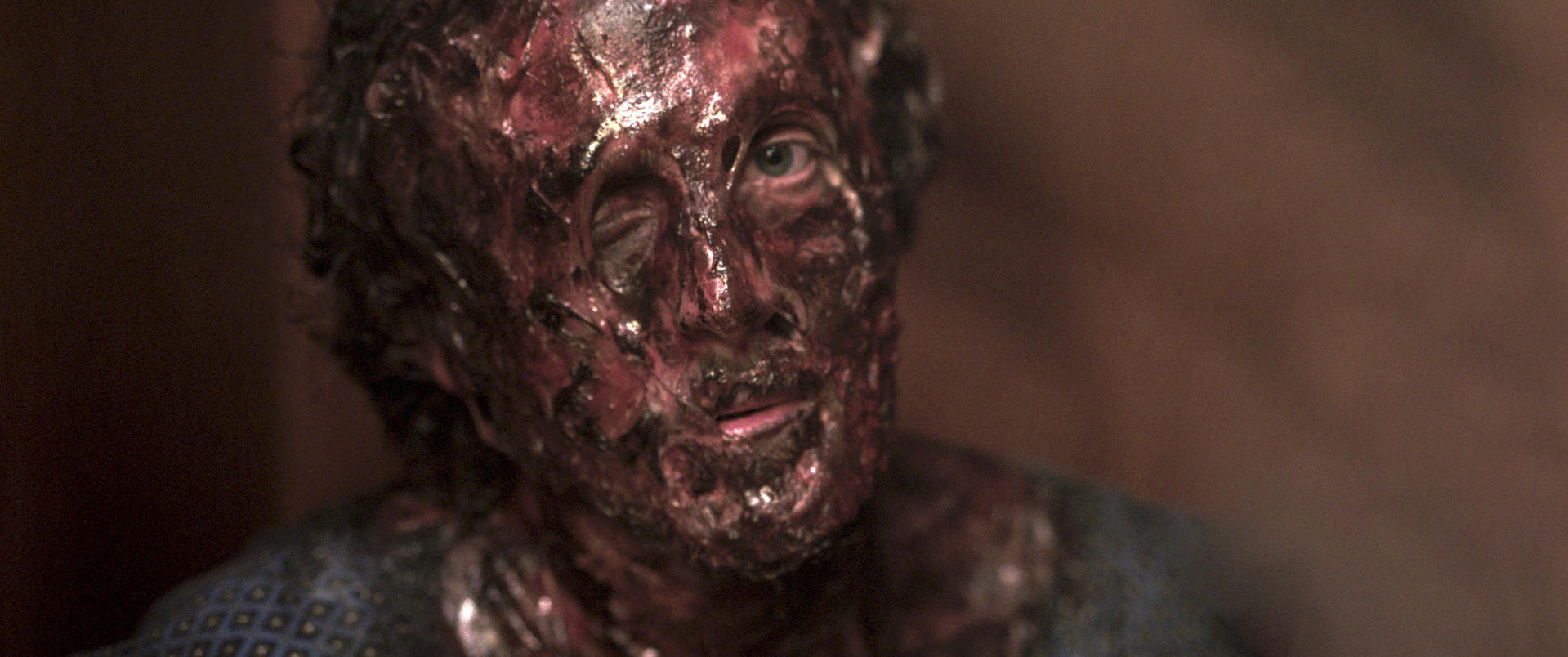 Das Gesicht einer Person ist mit Blut und Gore bedeckt, ein Auge offen.
