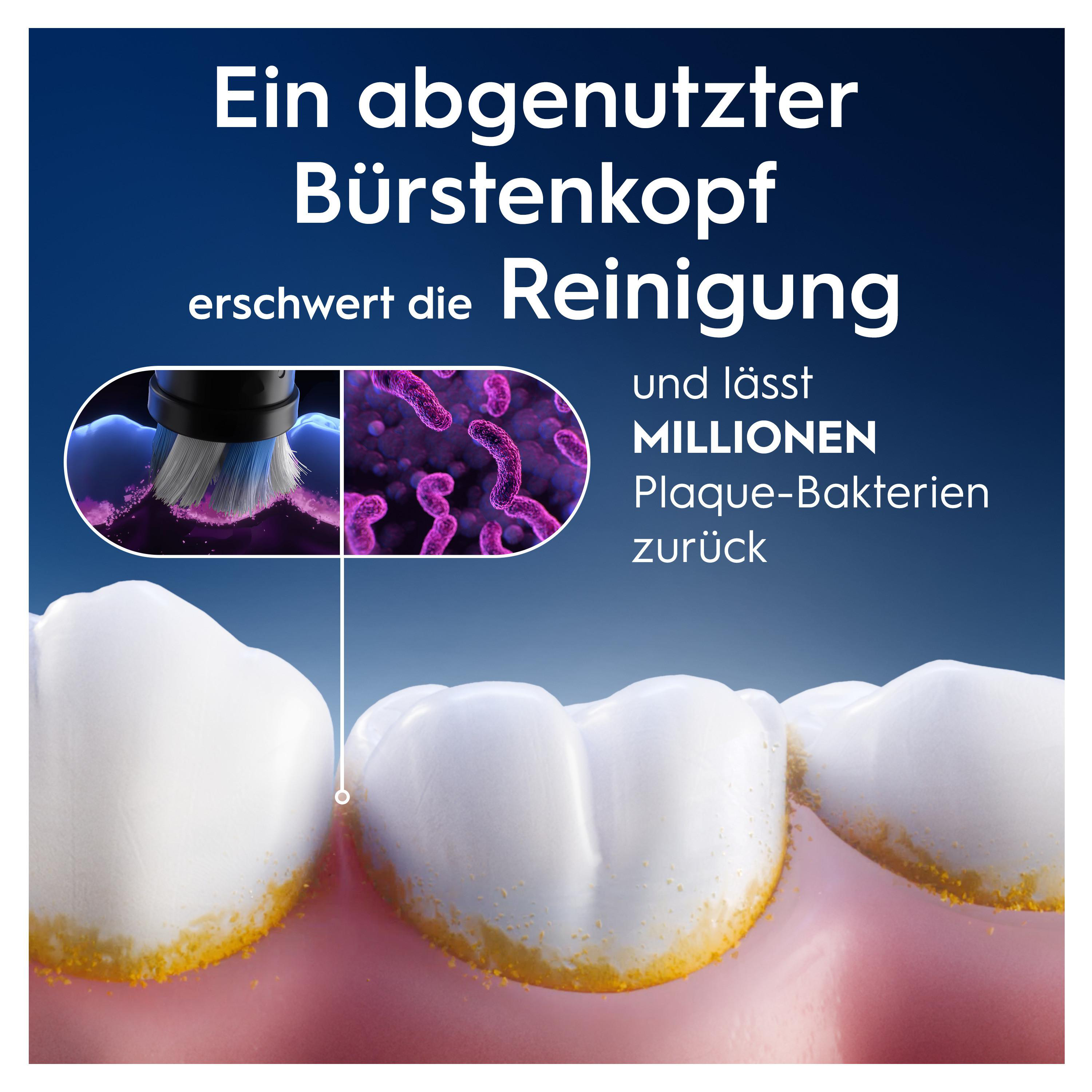 Zähne mit Plaquebildung und einer Bürste.