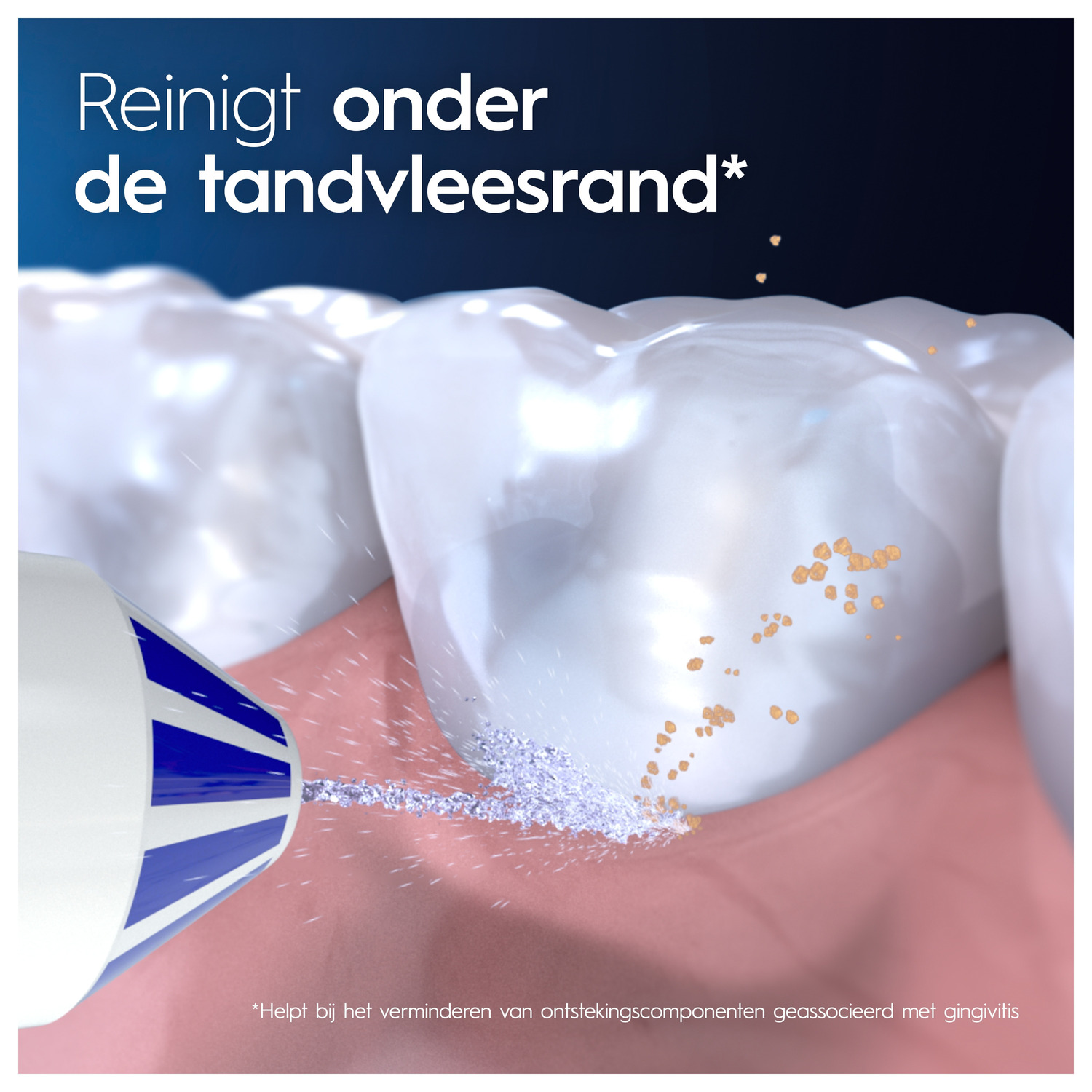 Teeth cleaning with water flosser, removing debris from gumline, close-up.