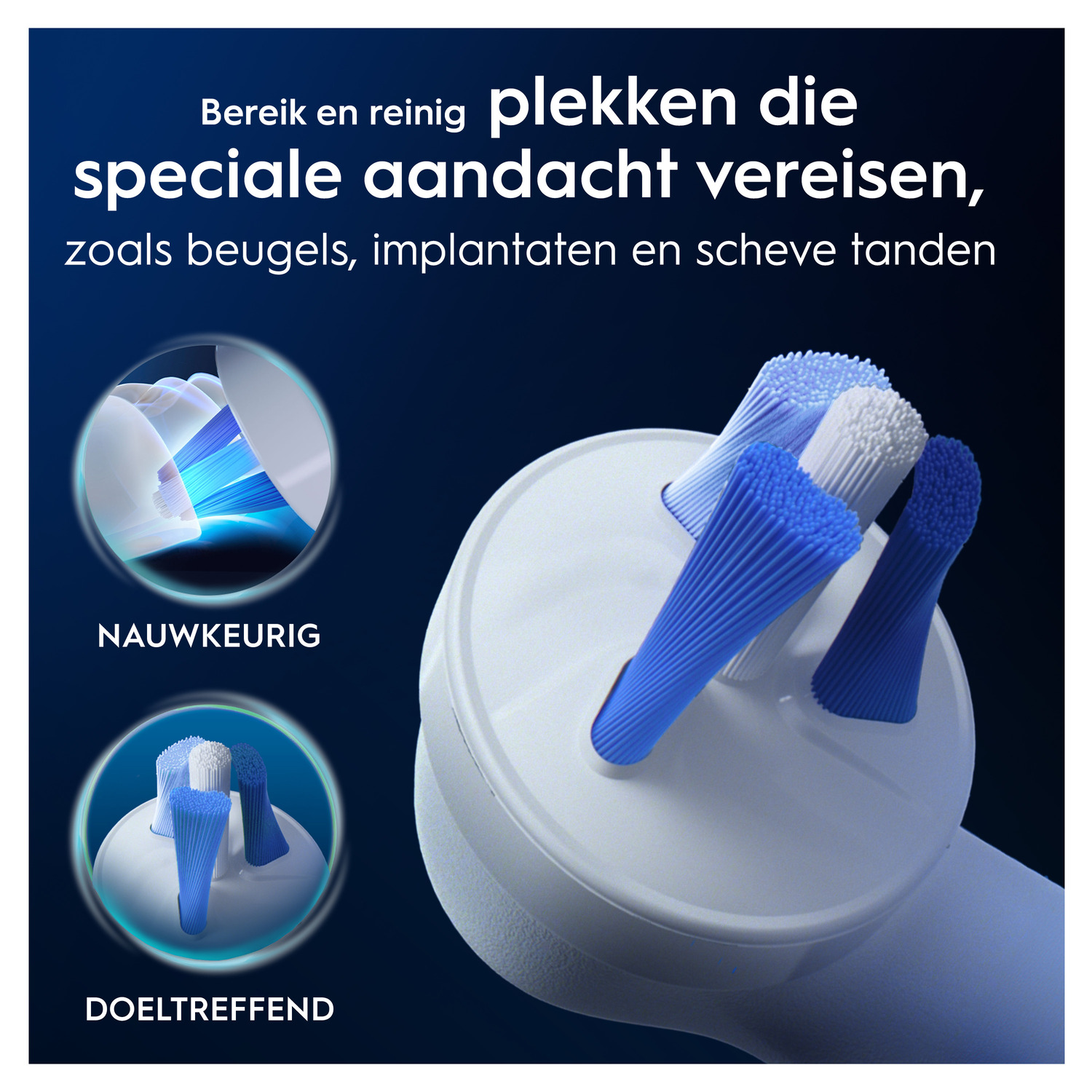 Tandenborstel die tanden reinigt, toont reiniging in moeilijke gebieden zoals beugels.