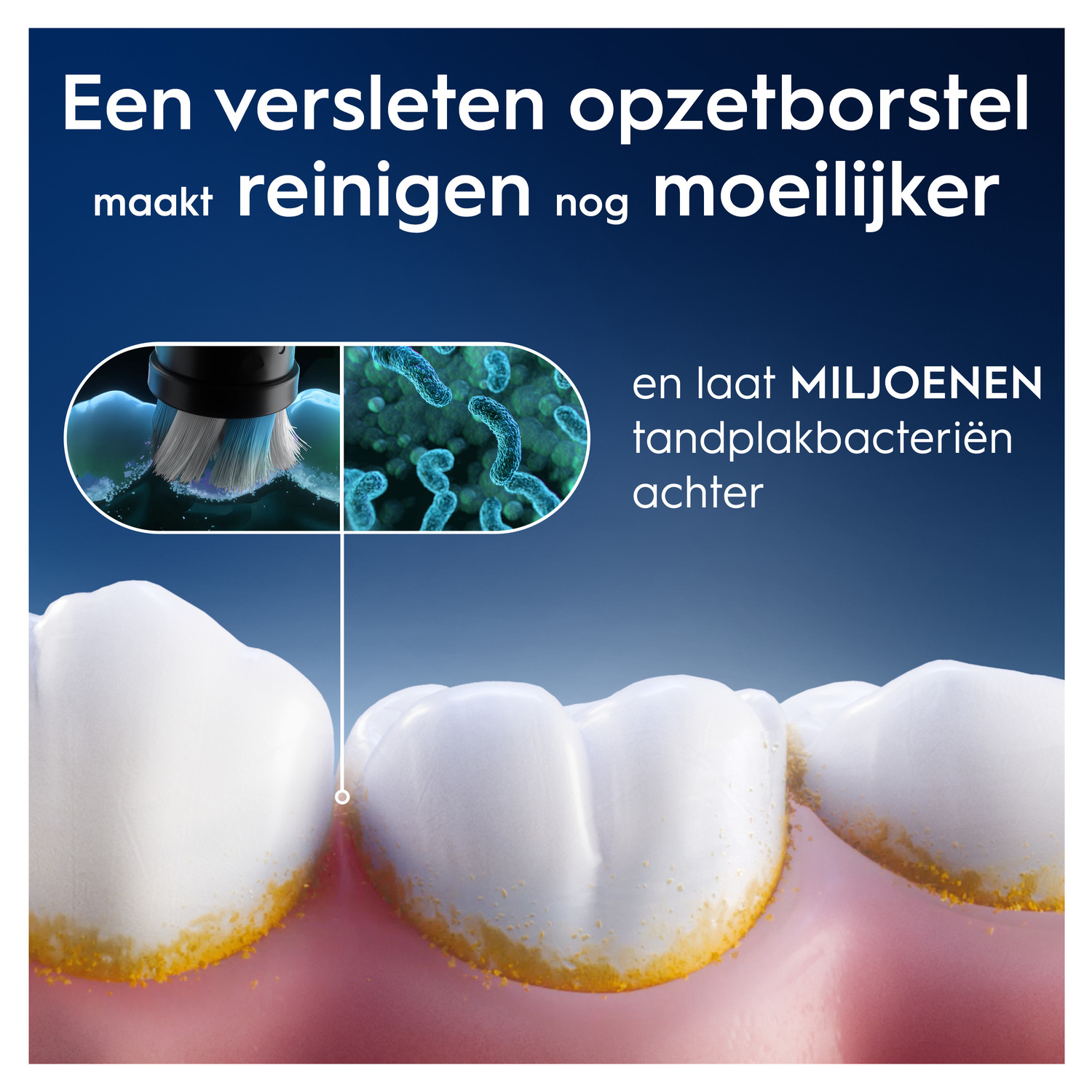 Close-up van tanden met gele vlekken, tandenborstel en bacteriën illustraties.
