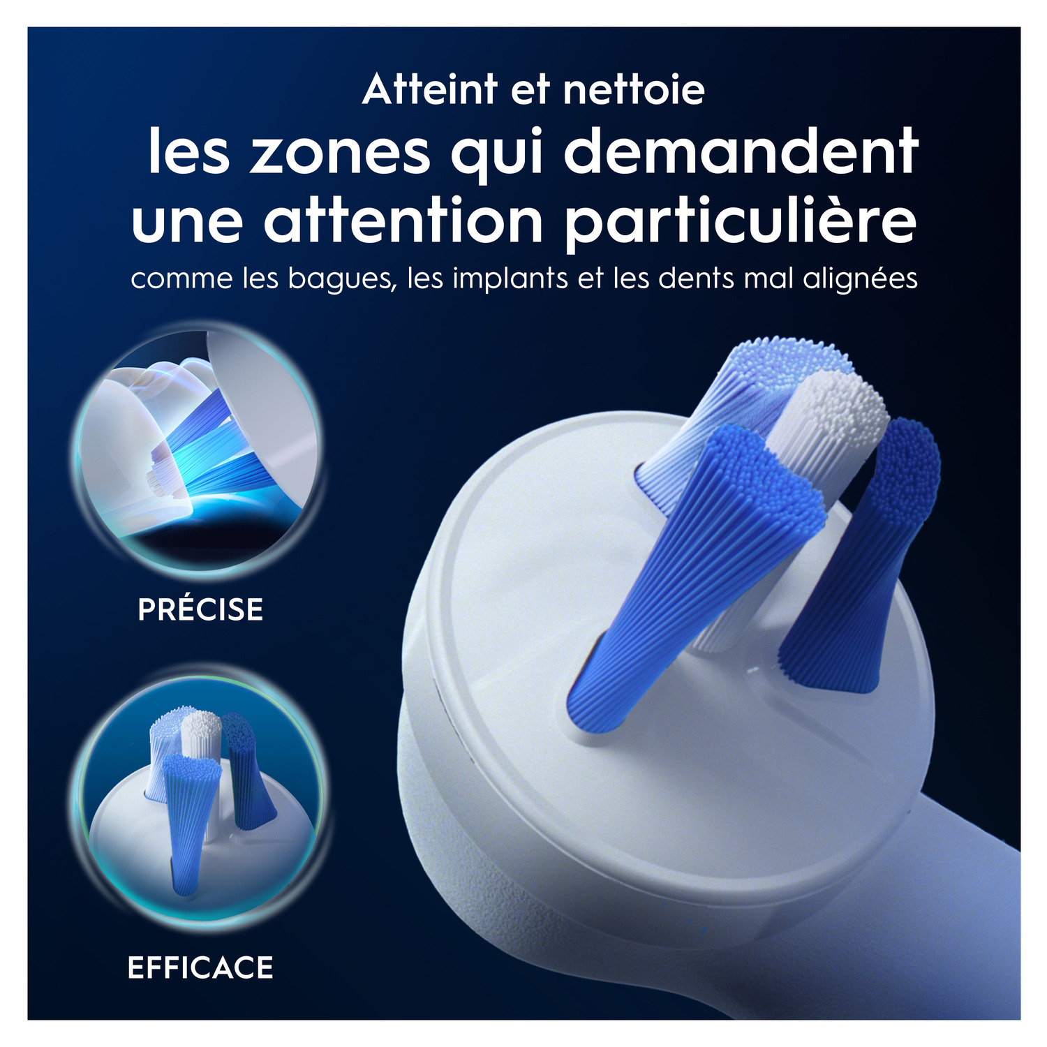 Tête de brosse à dents nettoyant les dents, avec un focus sur les zones nécessitant une attention particulière, comme les bagues.