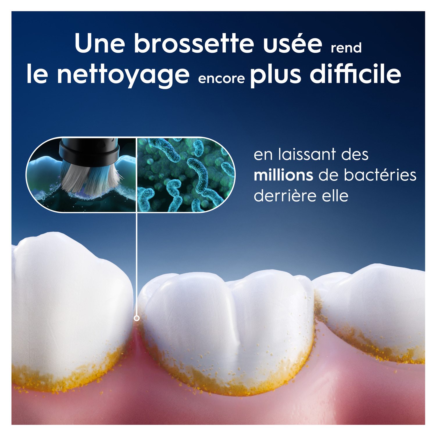 Gros plan sur les dents avec des taches jaunes, montrant qu'une brosse à dents usagée rend le nettoyage plus difficile.
