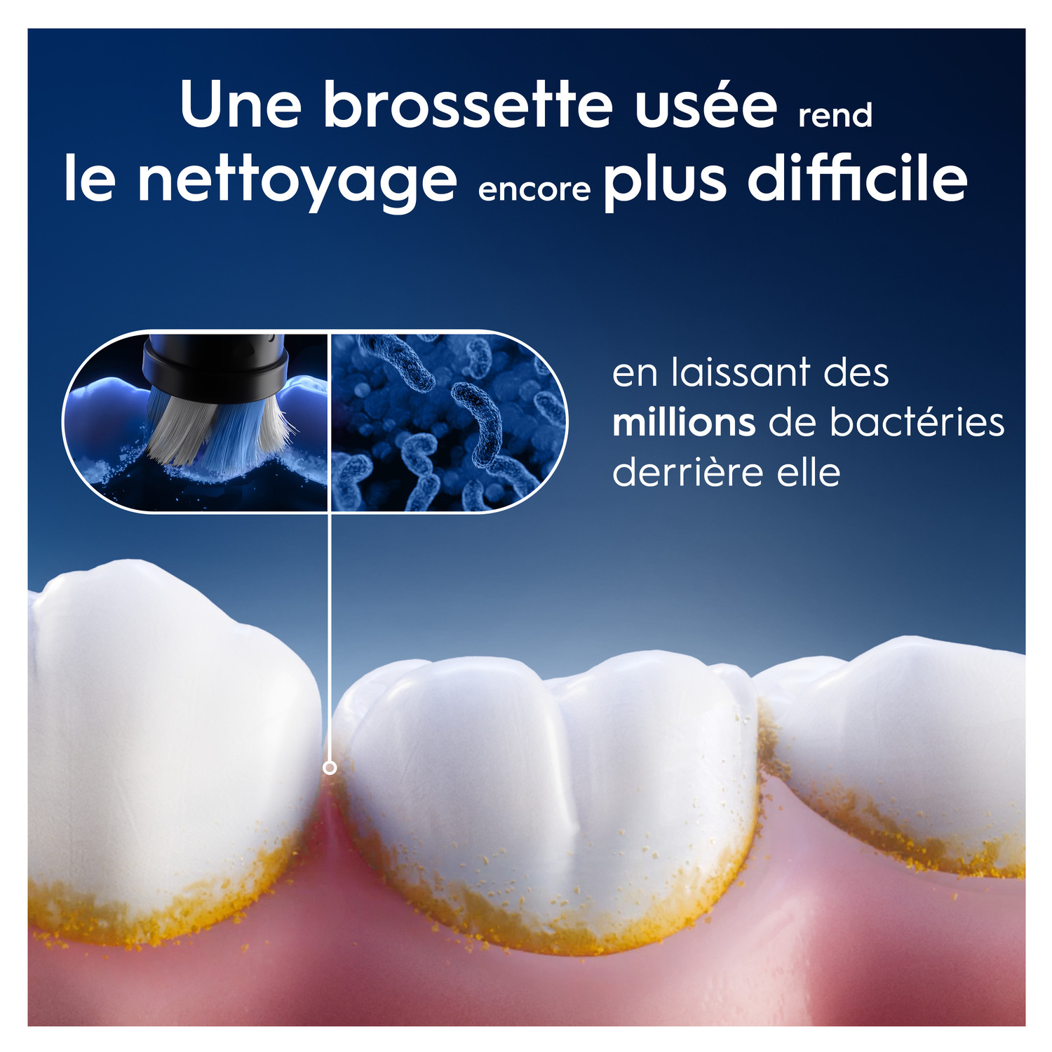 L'image montre une tête de brosse à dents usagée à côté de dents avec de la plaque. Le texte dit qu'une brosse usagée rend le nettoyage plus difficile.
