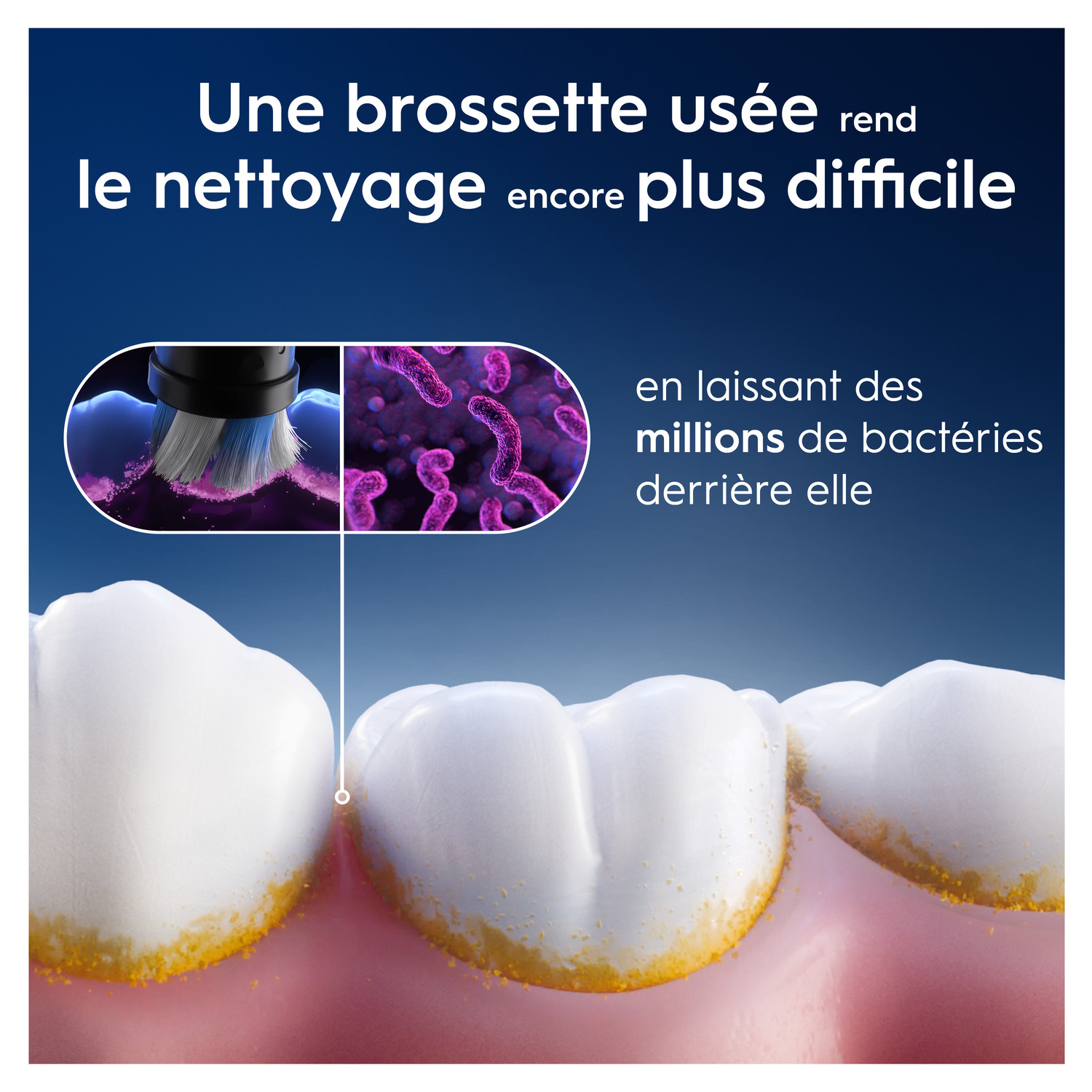 Gros plan sur des dents avec de la plaque jaune, image de brossage et de bactéries. Texte : Une brosse usée rend le nettoyage plus difficile.