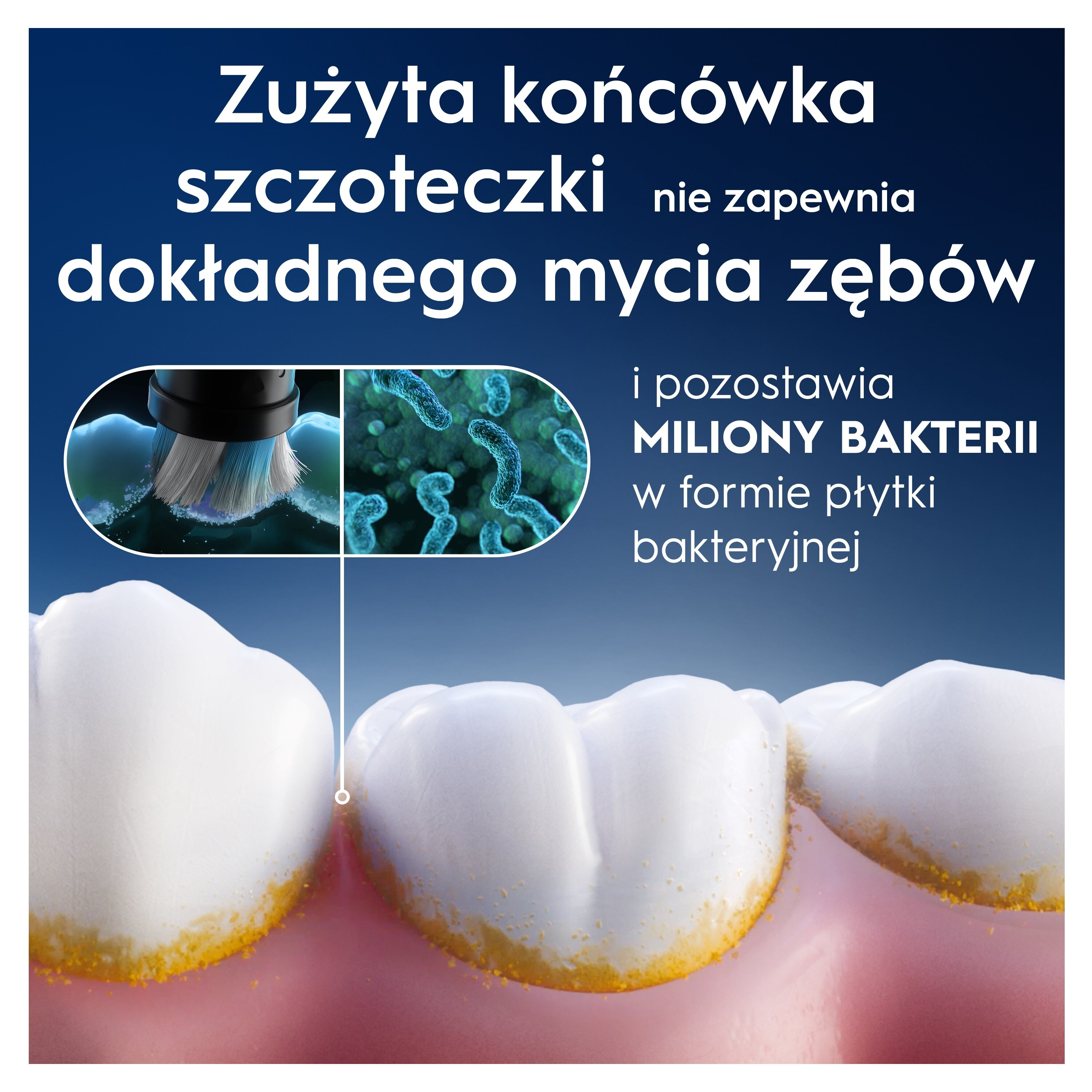 Obraz przedstawia zęby z płytką nazębną, szczoteczkę do zębów i ilustracje bakterii, wskazujące na słabe czyszczenie.