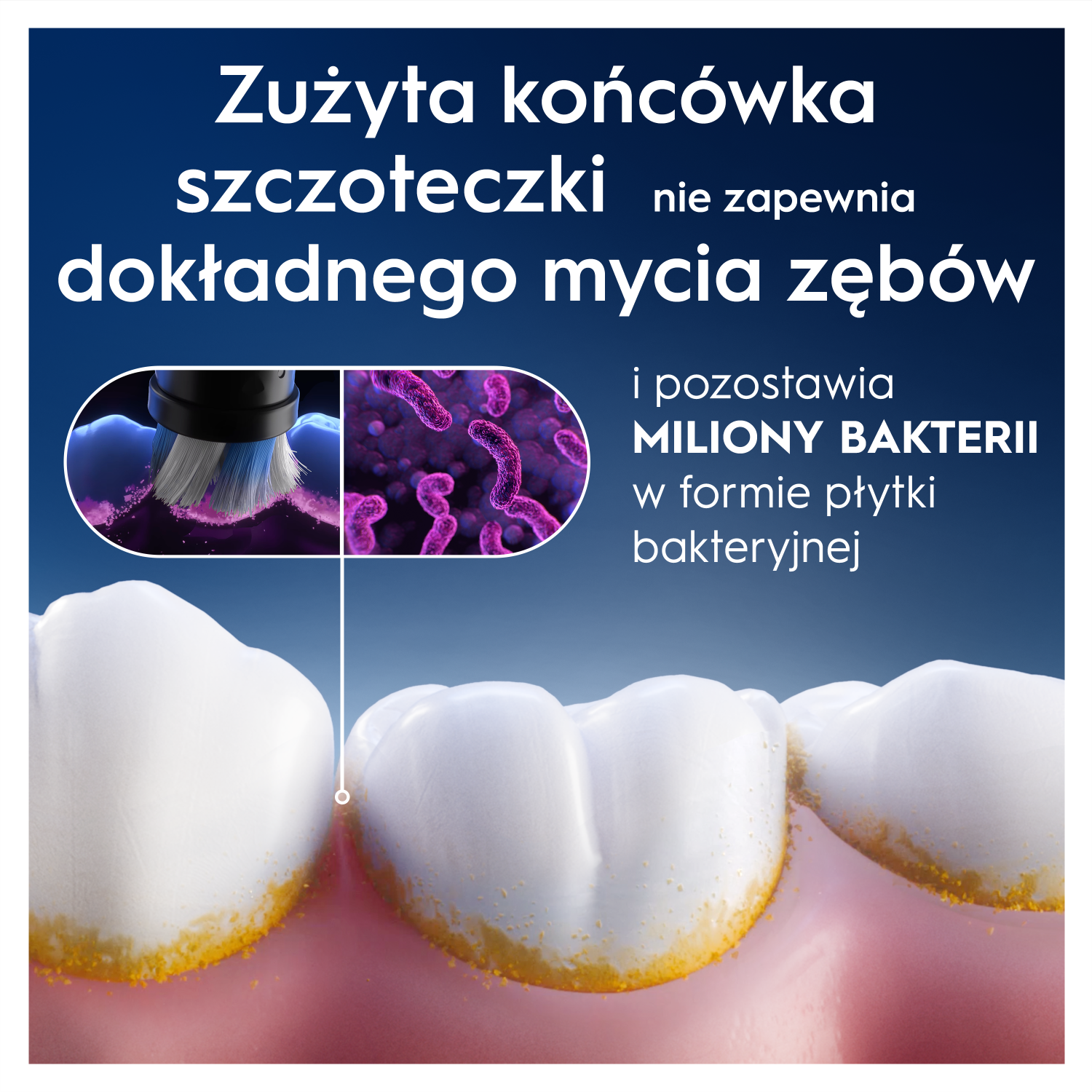 Zdjęcie przedstawia zęby z płytką nazębną. Tekst mówi, że zużyta końcówka szczoteczki nie czyści zębów prawidłowo i pozostawia miliony bakterii.