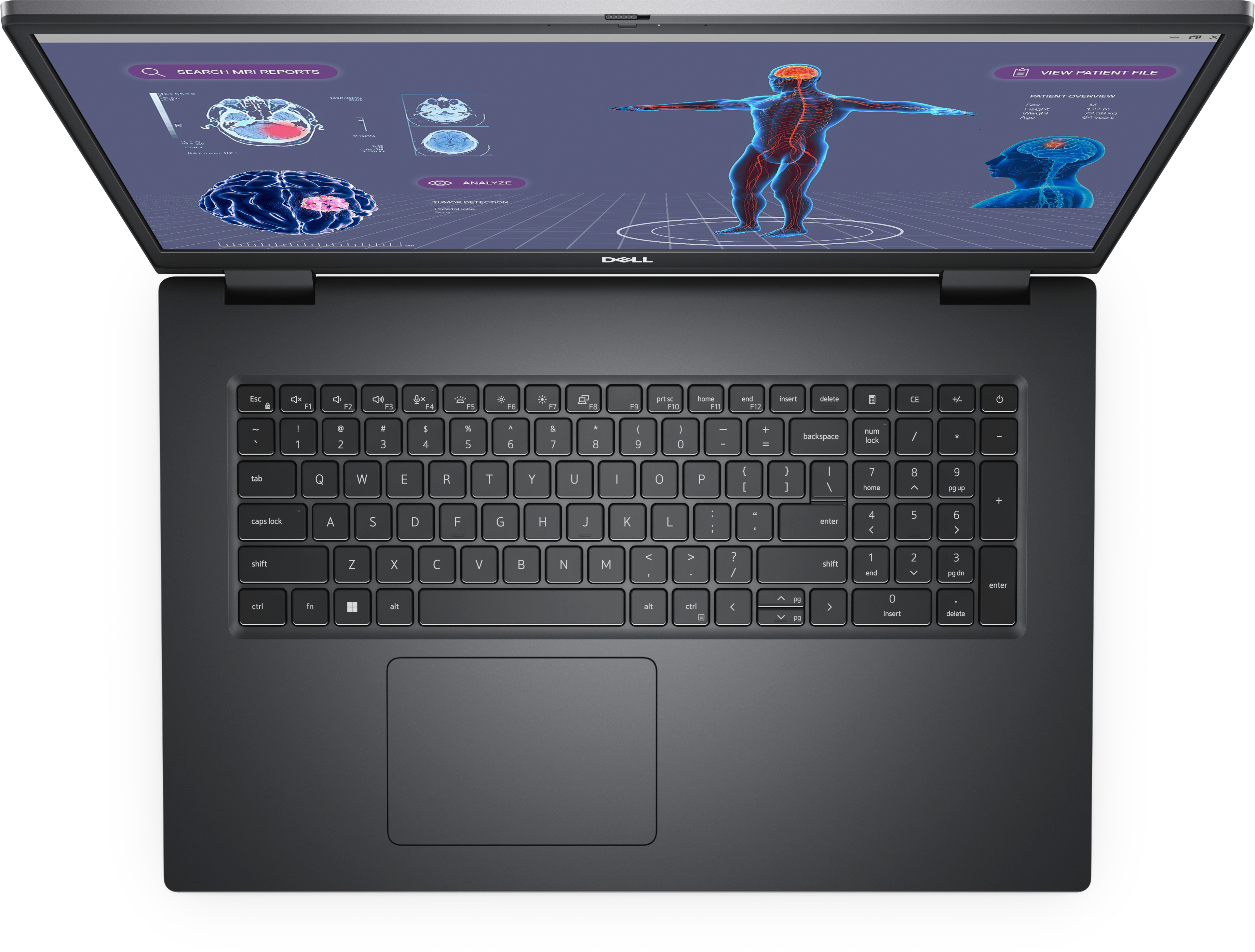 Ein Laptop mit medizinischen Bildern. Der Bildschirm zeigt Gehirnscans und eine menschliche Figur mit hervorgehobenem Nervensystem.