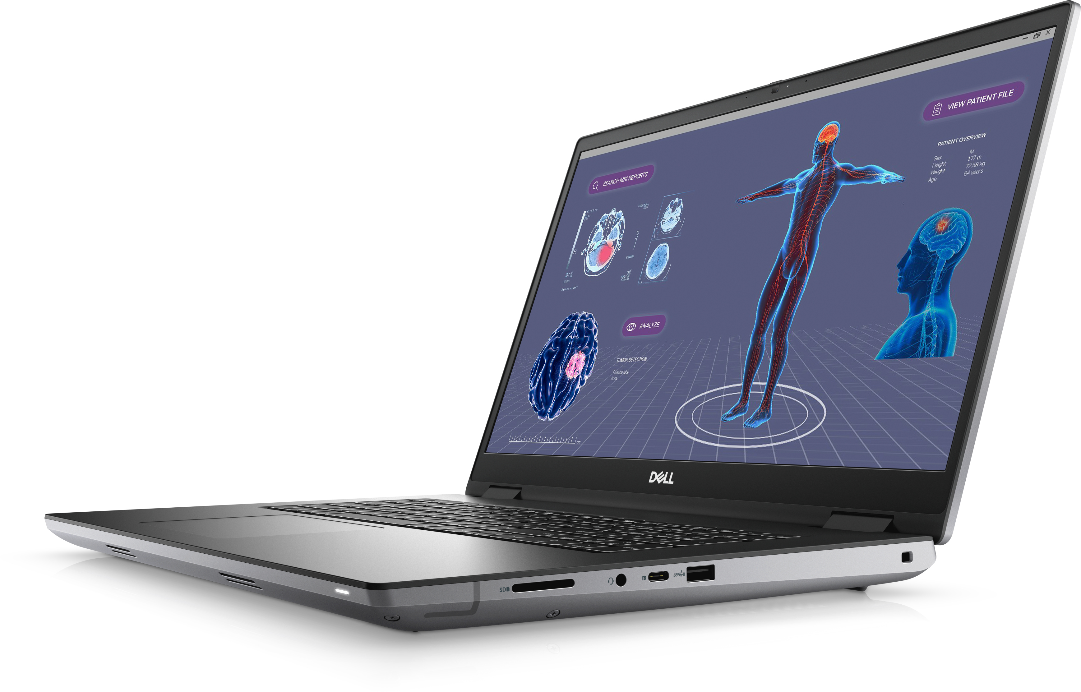 Ein Laptop zeigt einen medizinischen Scan, der eine menschliche Figur mit hervorgehobenen Venen und ein Gehirnscan-Bild zeigt.