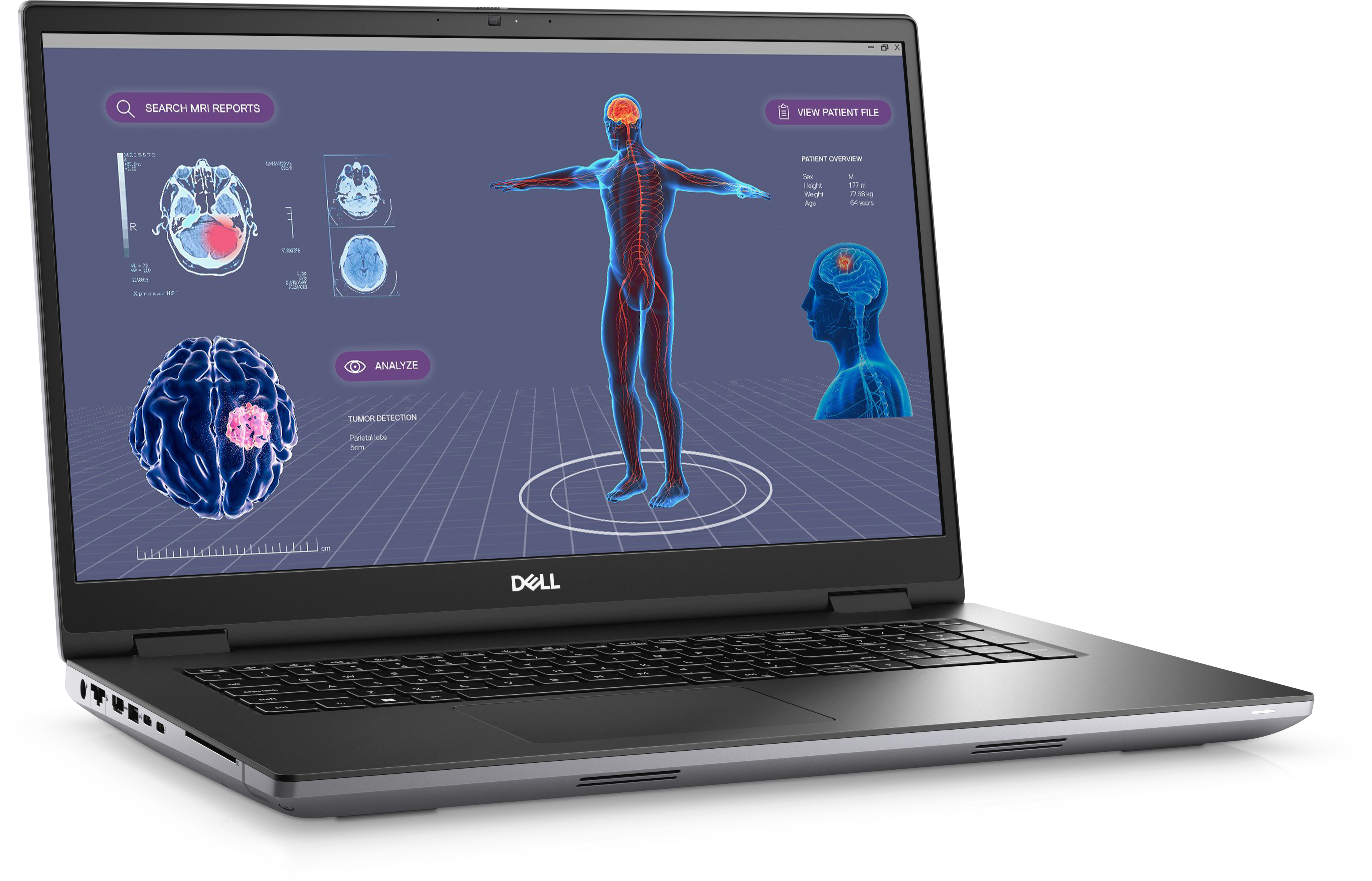 Laptop-Bildschirm mit medizinischer Scananalyse. Ein menschliches Körpermodell steht im Zentrum. Dell-Logo unten.