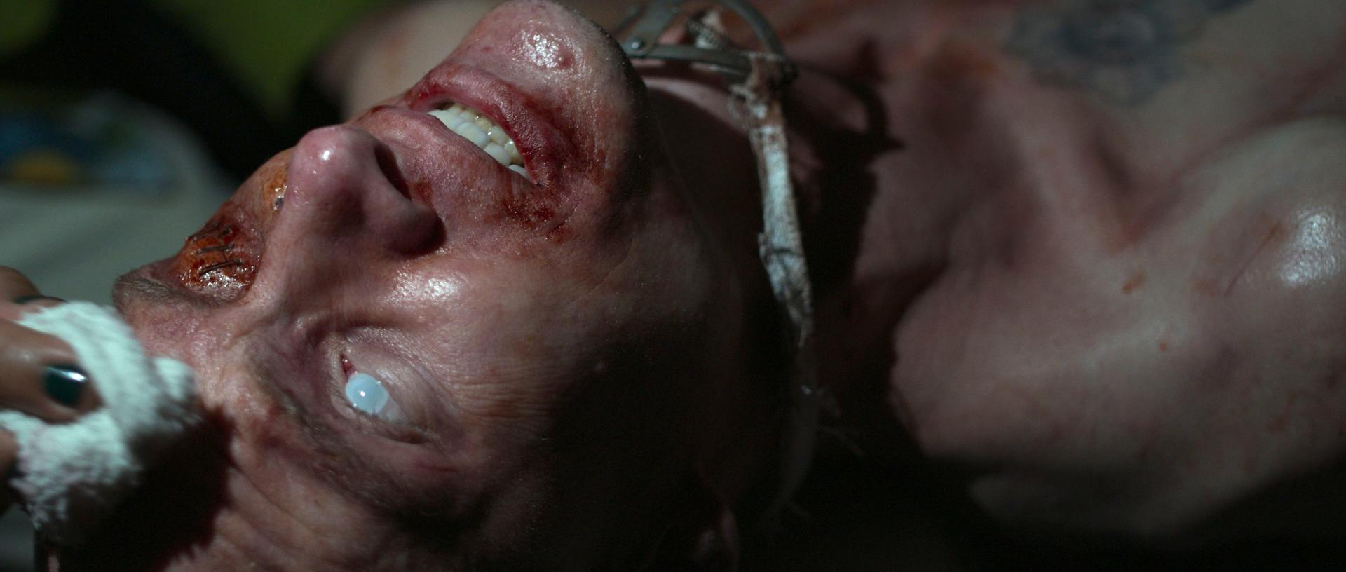 Nahaufnahme eines Mannes mit Verletzungen. Blut und genähte Wunden sind sichtbar. Eine Hand hält ein Tuch.