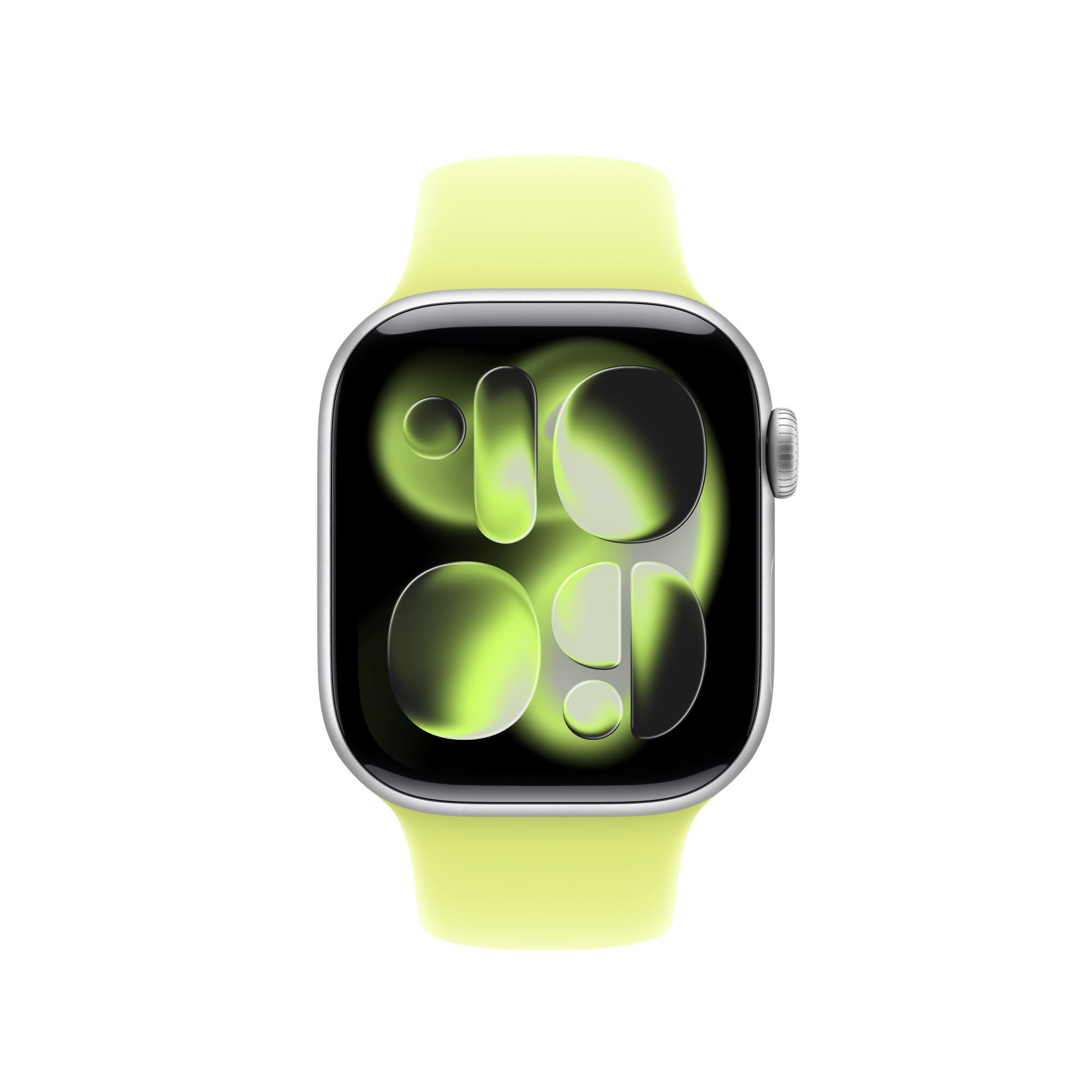 Eine Apple Watch mit gelbem Armband. Der Bildschirm zeigt die Uhrzeit mit grünem und schwarzem Hintergrund.