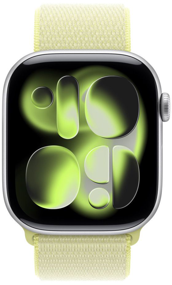 Apple Watch világossárga szíjjal és zöld-fekete számlappal. A számlap egy grafikát mutat.