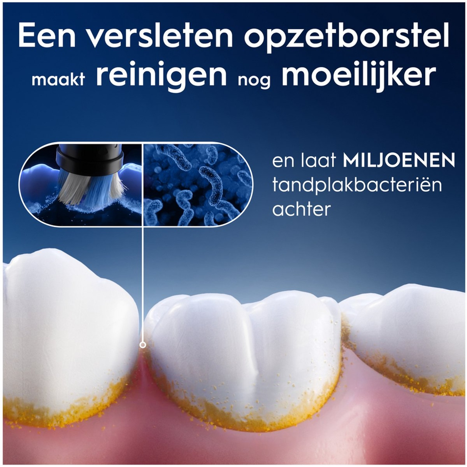 L'image montre des dents avec de la plaque, une tête de brosse à dents usée et des bactéries. Le texte dit qu'une brosse usée rend le nettoyage plus difficile.