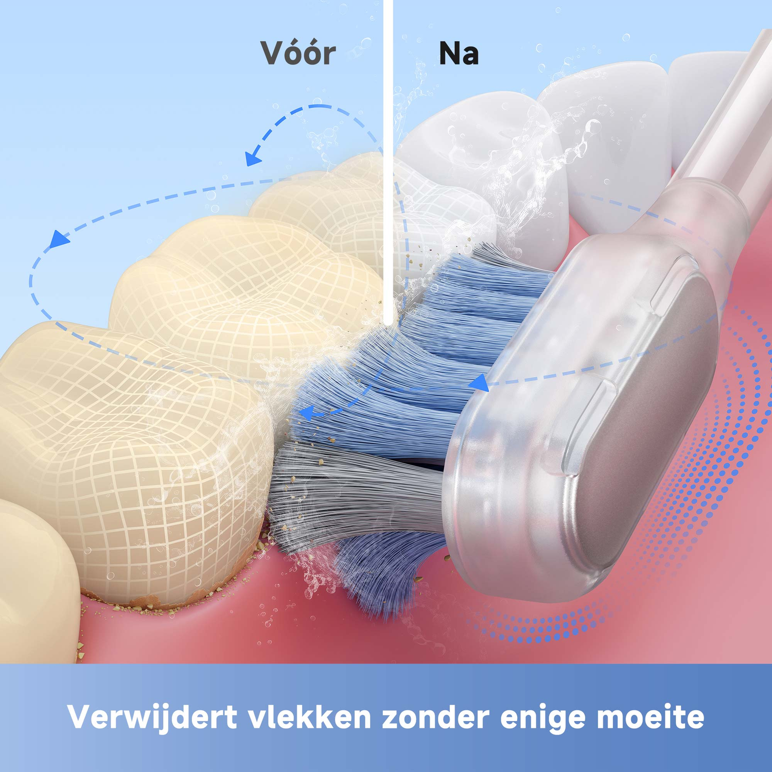Teeth before and after brushing with a toothbrush. The left side shows stained teeth, the right side clean teeth.