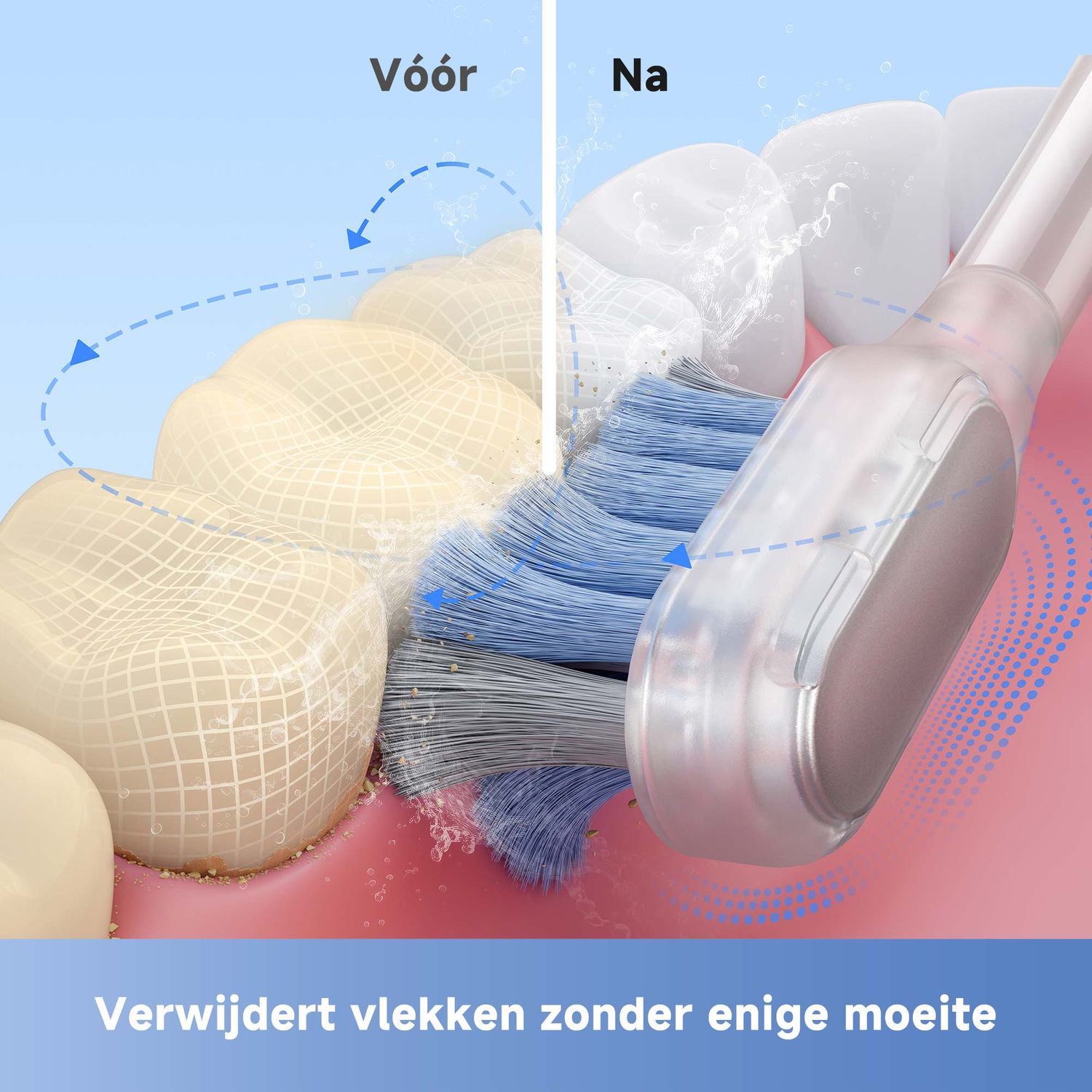 Image shows teeth cleaning with a toothbrush. Before cleaning, teeth are stained; after, they are white. The brush has blue bristles.