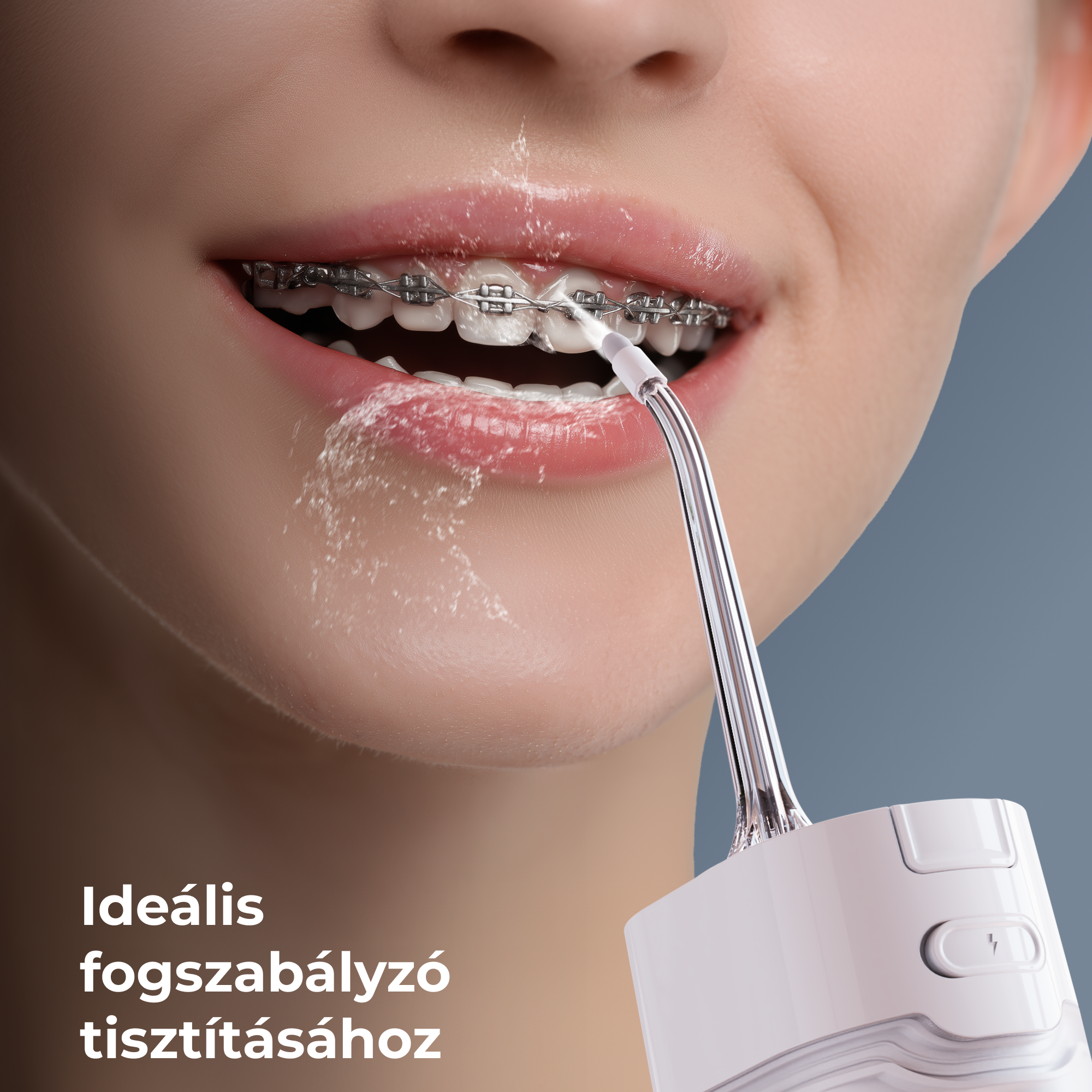 Közelkép a fogszabályzós szájról, amelyet vízsugárral tisztítanak. Fehér készülék jobbra, kékesszürke háttérrel.