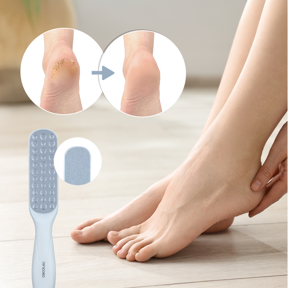 La imagen muestra un producto para el cuidado de los pies con vistas de antes y después. El pie con talón agrietado se transforma en piel lisa. Producto visible.