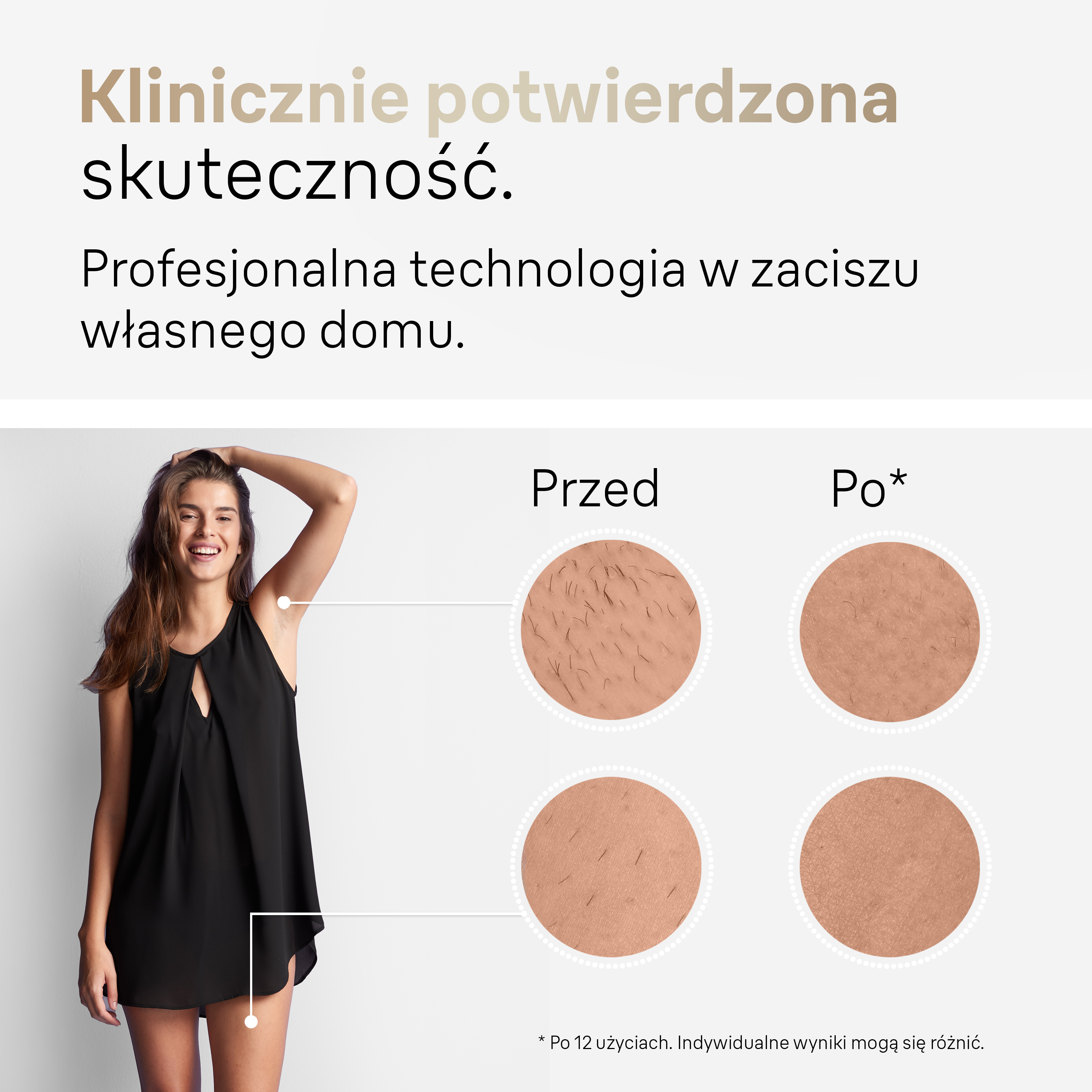 Kobieta w czarnej sukience, uniesione ramię, zdjęcia porównawcze przed i po depilacji, z tekstem.