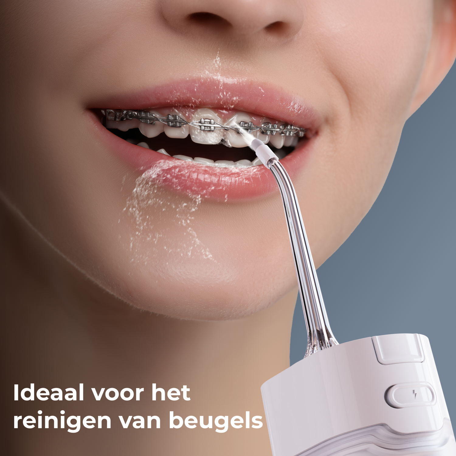 Close-up of a person's mouth with braces being cleaned by a water flosser. Water sprays out. White flosser in hand.