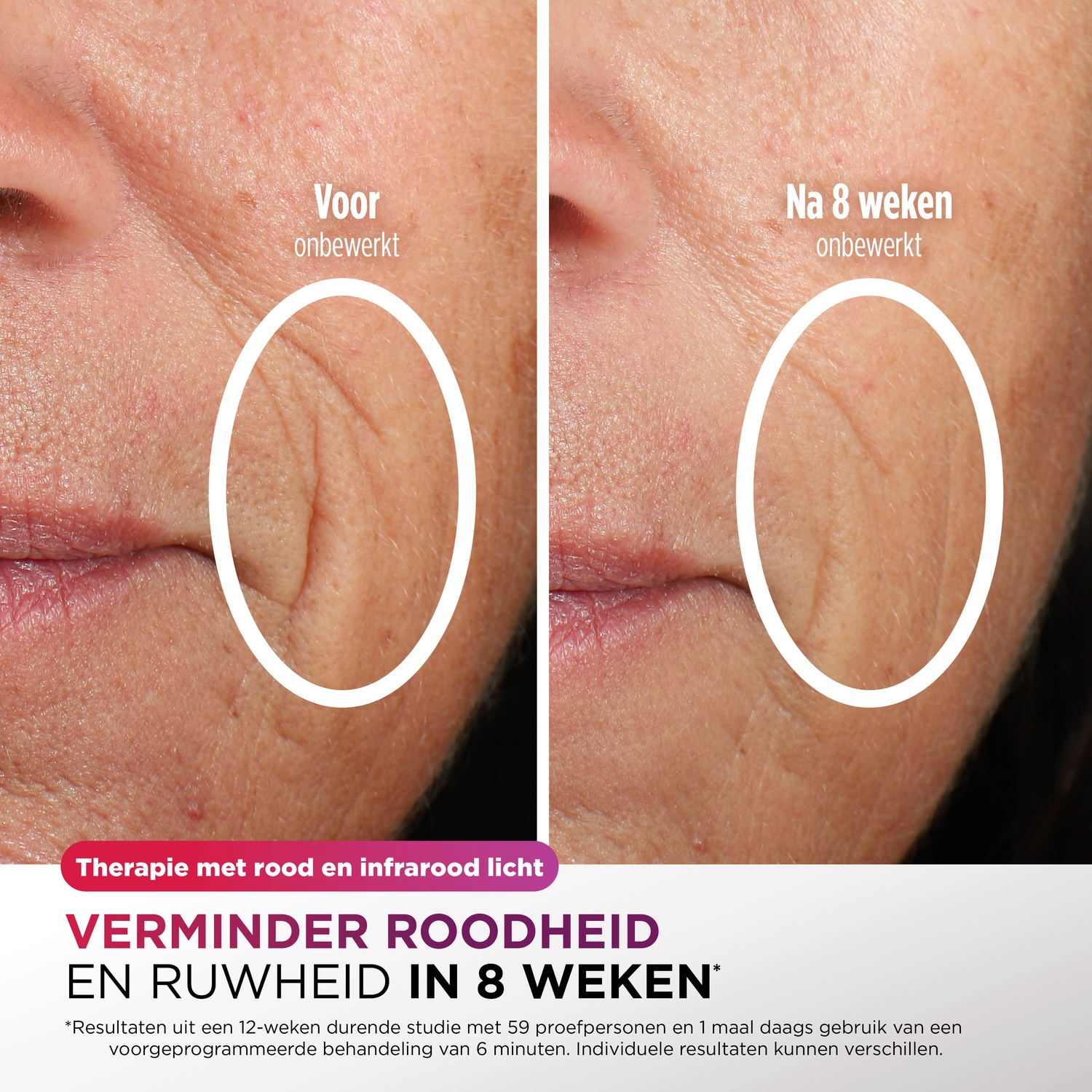 Side-by-side comparison of skin before and after treatment. Shows reduction of wrinkles and redness. Text highlights the 8-week improvement.