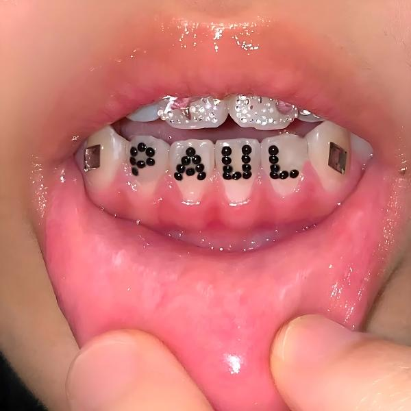 Nahaufnahme eines Mundes mit Zahnspange. Das Wort "PAUL" ist mit schwarzen Punkten auf den Zähnen geschrieben. Lippen sind rosa.