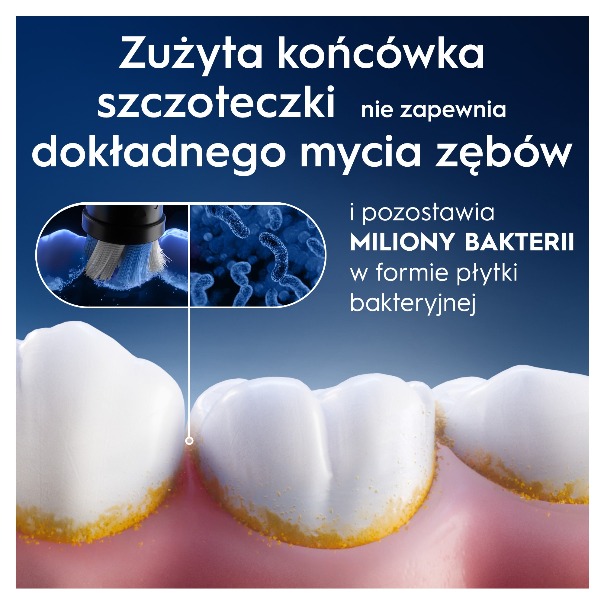 Obraz przedstawia zęby z płytką nazębną, szczoteczkę do zębów i bakterie, ilustrując, dlaczego zużyta szczoteczka nie czyści dobrze.