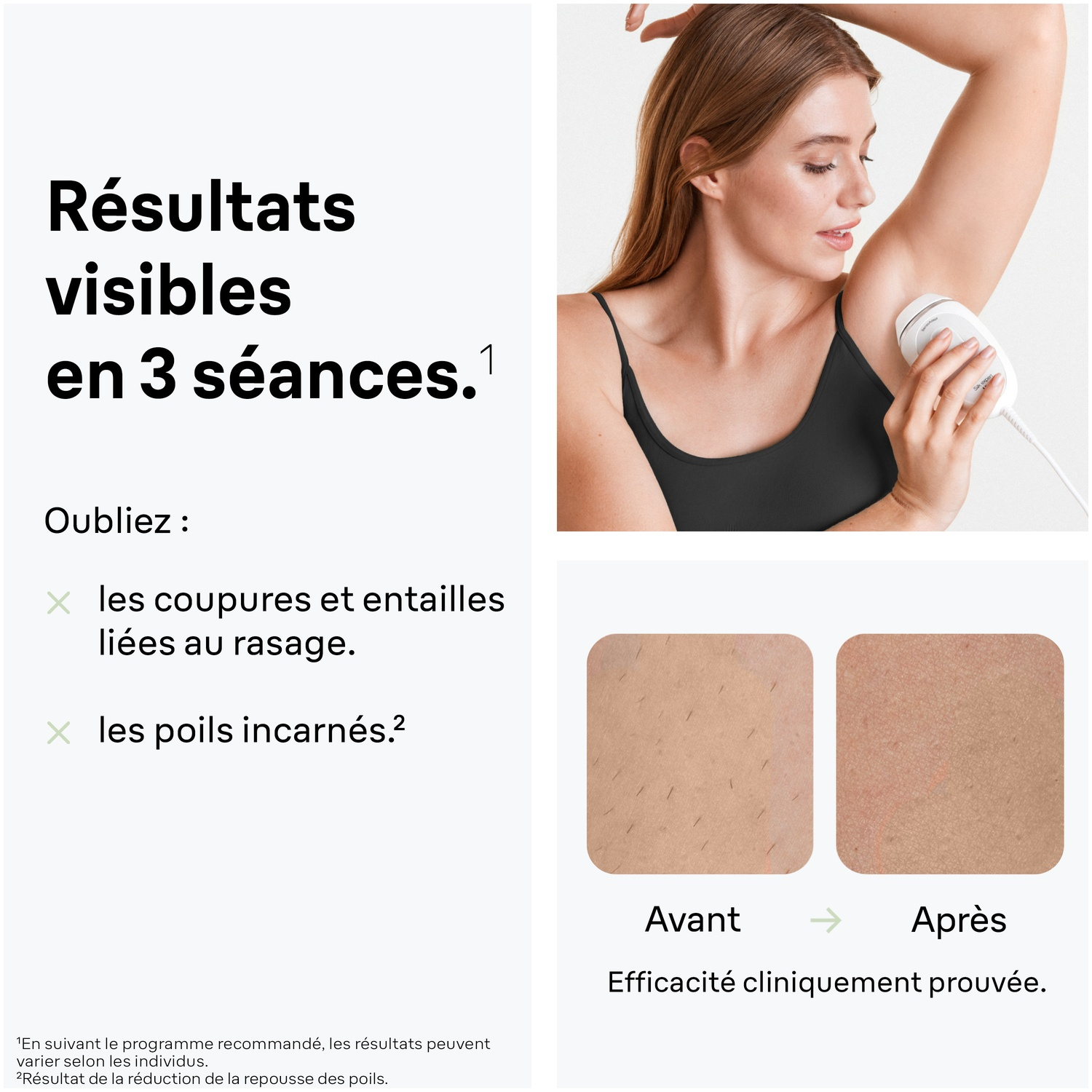 L'image montre une femme utilisant un appareil d'épilation. Le texte dit 'Résultats visibles en 3 séances'. Les images avant/après montrent la réduction des poils.