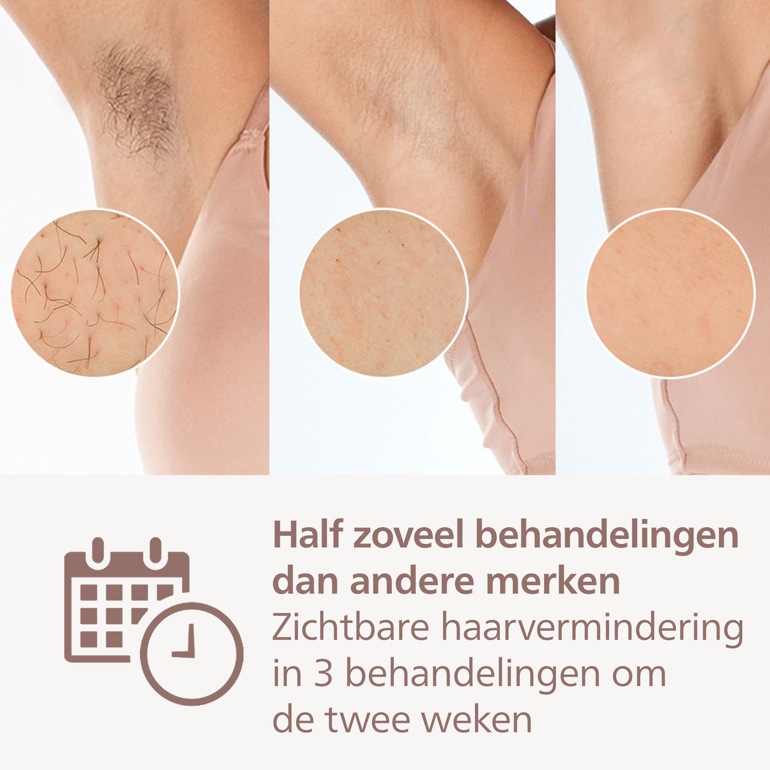 Image shows armpits with hair before and after treatment. The text mentions fewer treatments and visible hair reduction in 3 weeks.