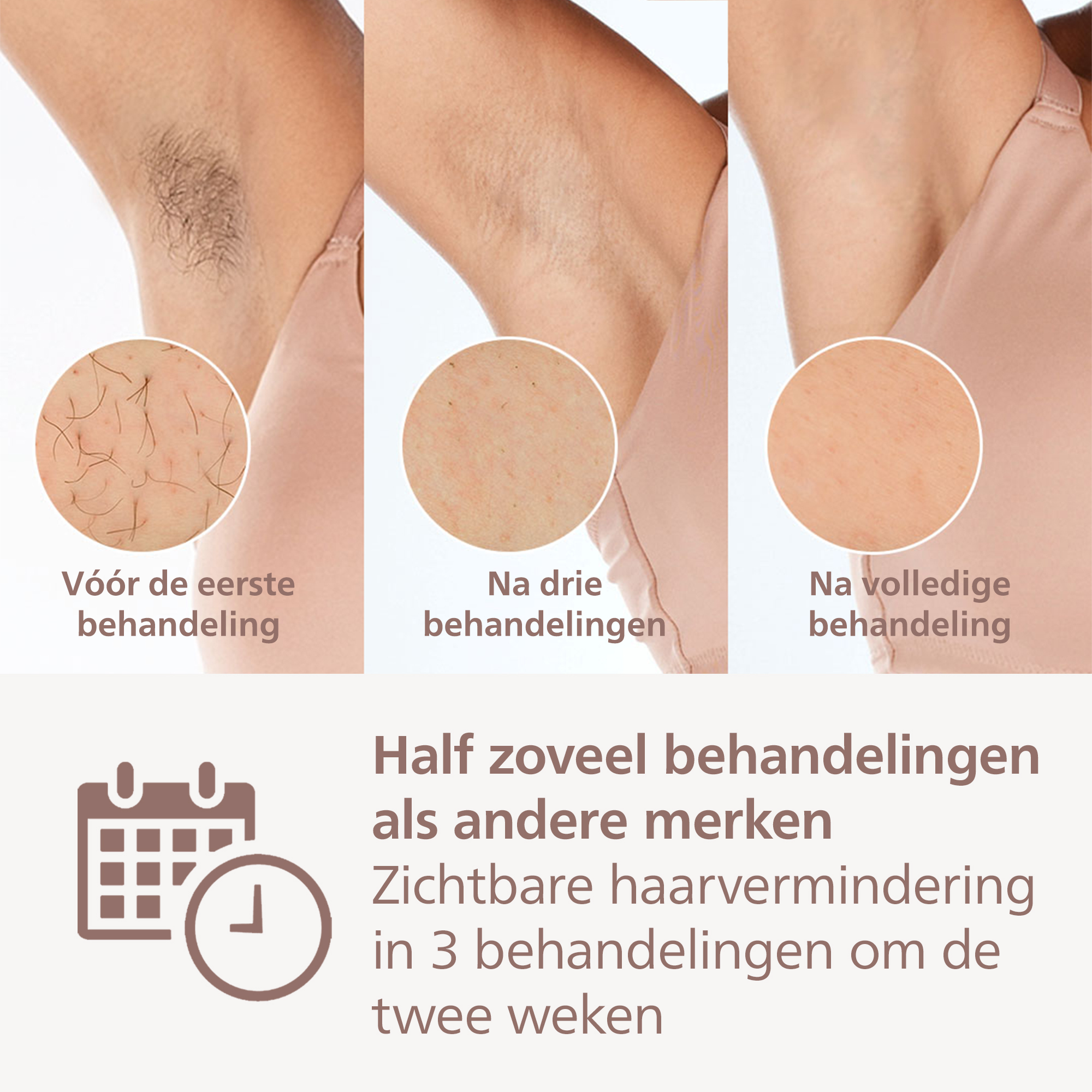 Image shows armpits before and after hair removal treatments. Text indicates hair reduction after three treatments.